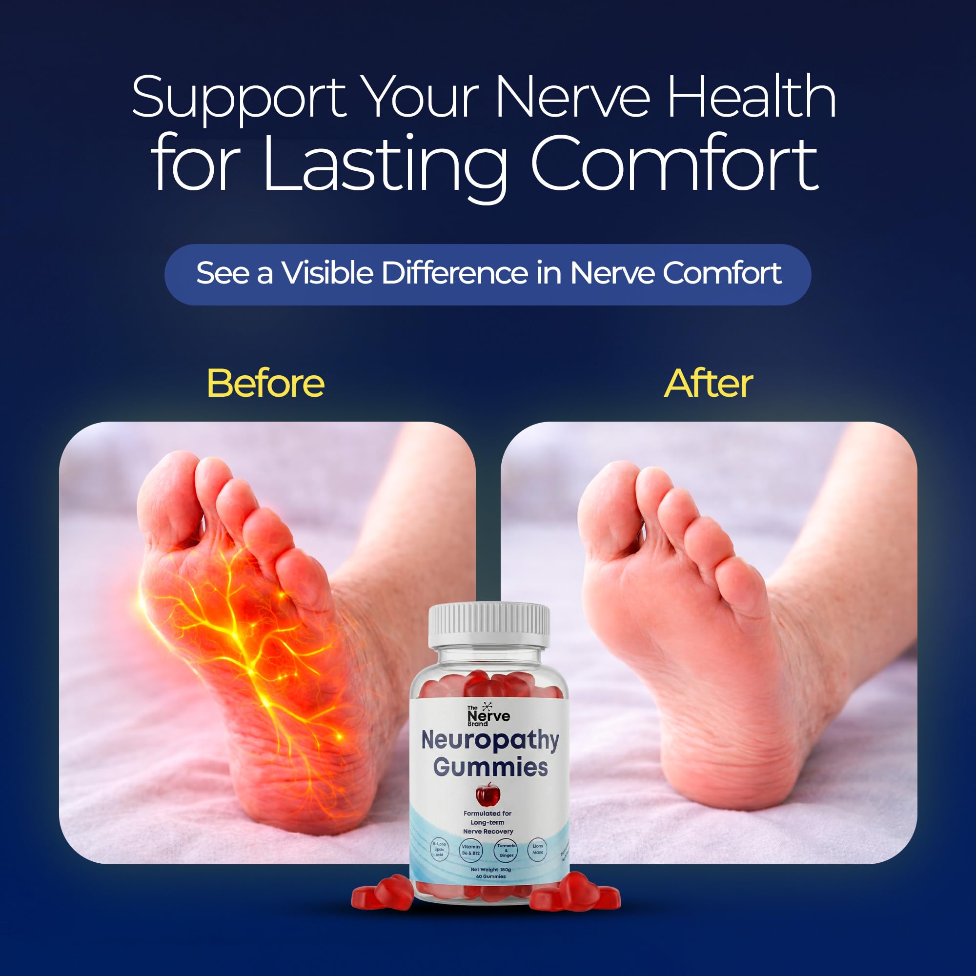 The Nerve Brand Neuropathy Support Gummies, 600 mg R Alpha Lipoic Acid Gummies with B1 B6 B12 and Lion’s Mane, Sugar Free Daily Nerve Health Supplement, 30 Day Supply The Nerve Brand buy supplements canada