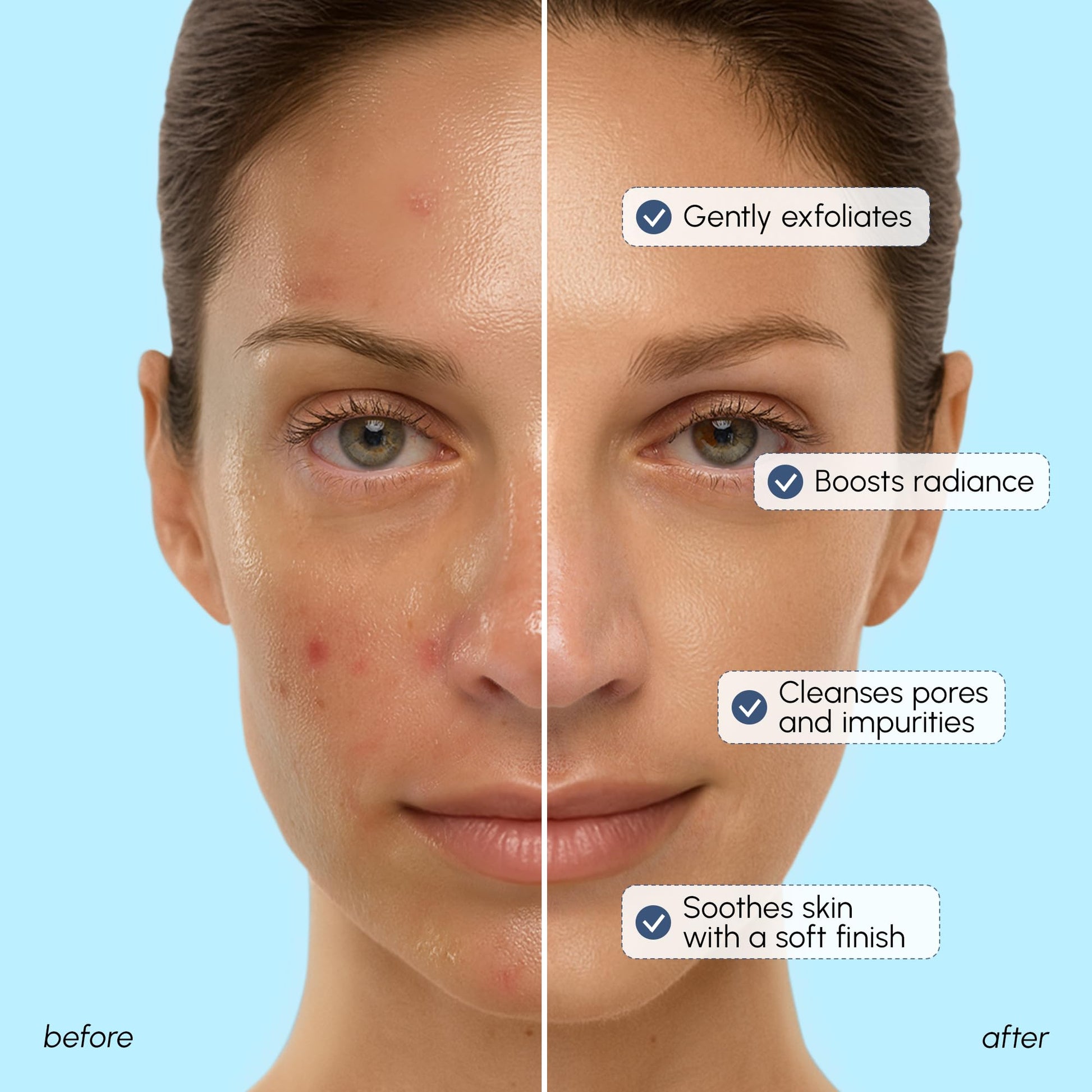 MAREE Face Exfoliator – Microdermabrasion Facial Scrub & Exfoliating Face Wash for Women – Collagen & Glycolic Acid – Gentle Scrub and Exfoliant MAREE buy supplements canada