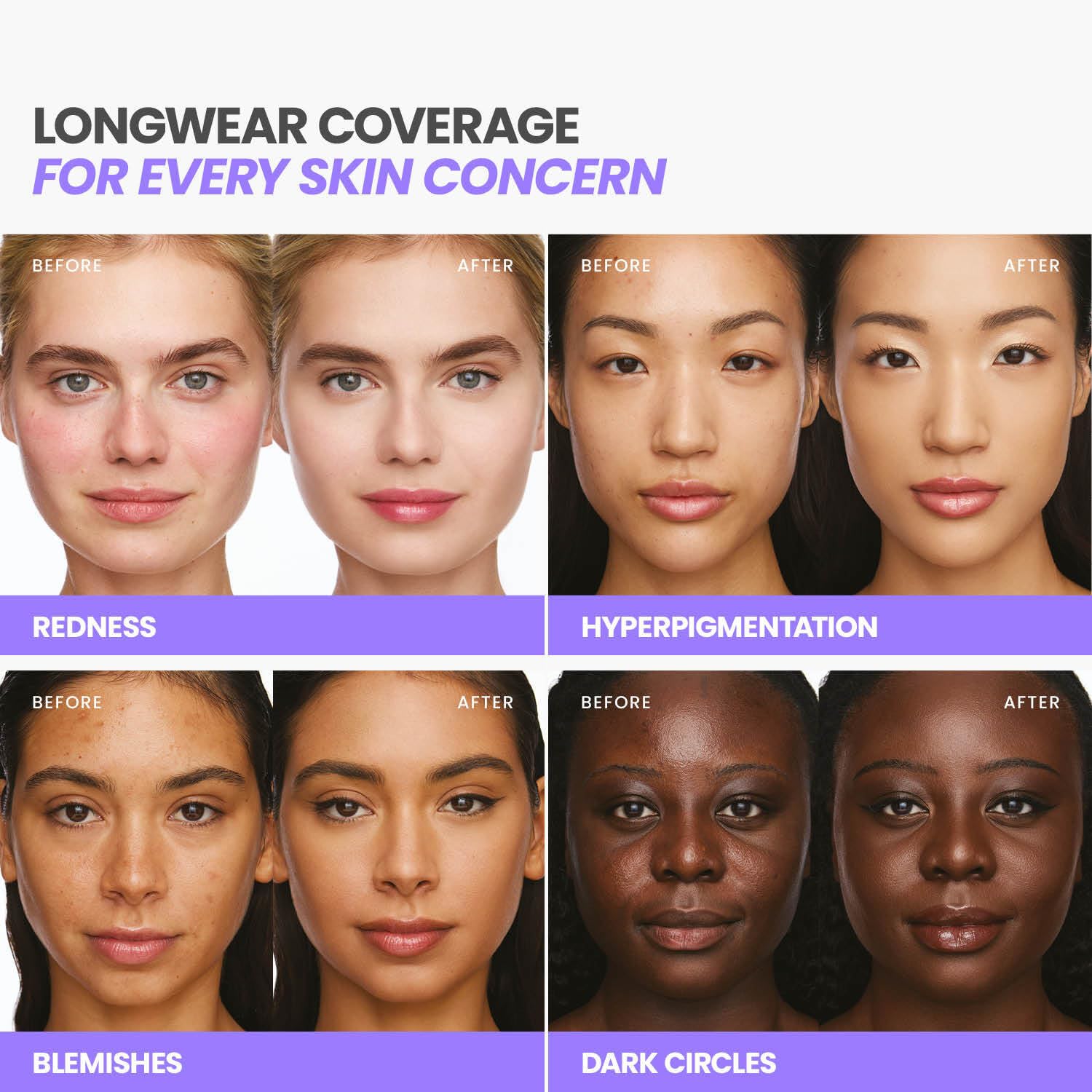 Wonderskin Hyper Bond All-Day Stay Serum Foundation – Waterproof, Transfer-Proof, 24HR Longwear Face Makeup with Niacinamide & Hyaluronic Acid – Lightweight, Natural Finish (Moonstone) Wonderskin buy supplements canada