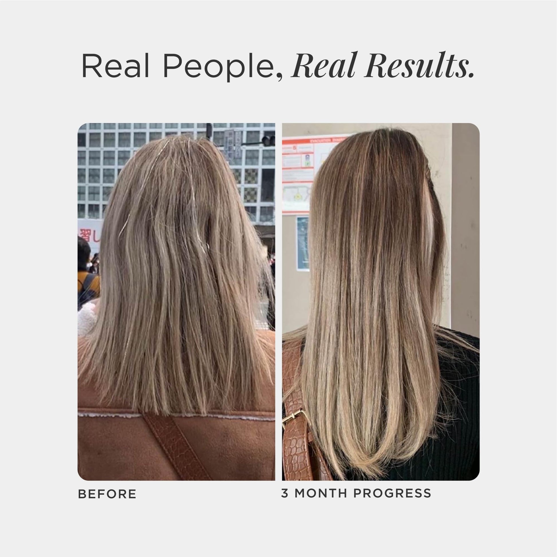 JSHealth Hair Growth Vitamins for Women. Hair + Energy with Kelp Iodine and Zinc. Supports Thickness, Strength, Energy. Nutritionist-Formulated (60 Capsules) JSHealth buy supplements canada