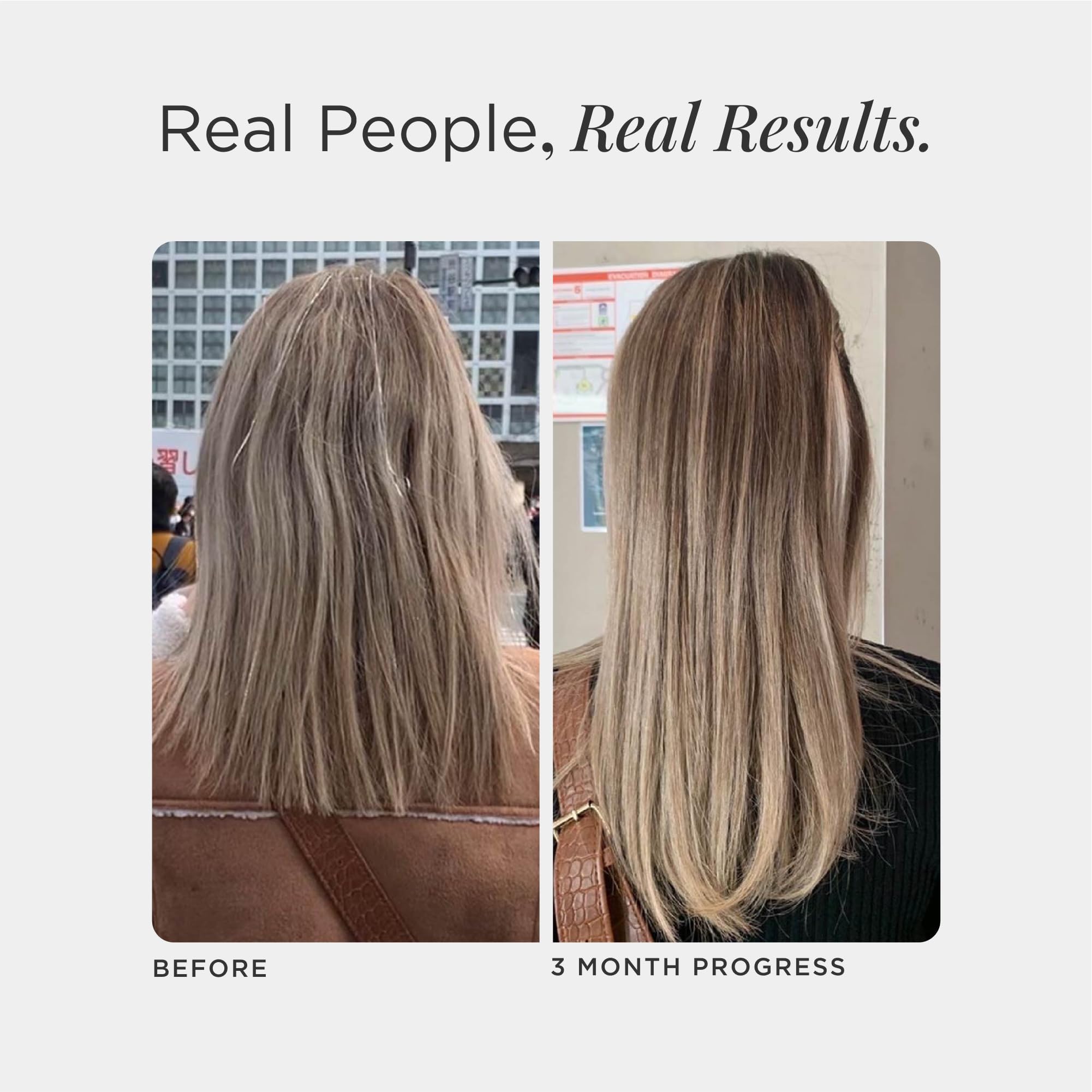 JSHealth Hair Growth Vitamins for Women. Hair + Energy with Kelp Iodine and Zinc. Supports Thickness, Strength, Energy. Nutritionist-Formulated (60 Capsules) JSHealth buy supplements canada