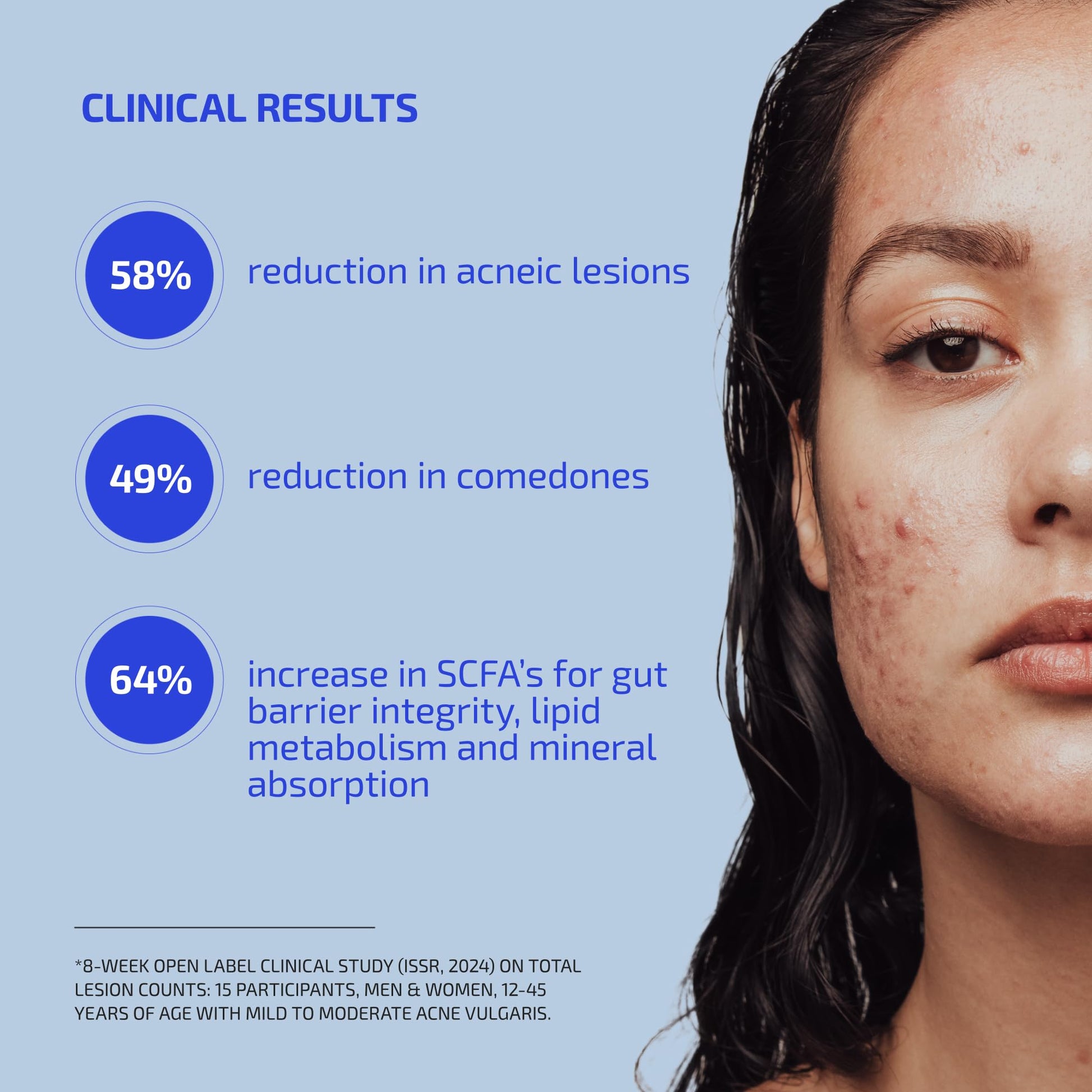 Codex Labs Shaant Clear Skin Supplement – 60 Vegan Capsules | Acne Probiotics with 9-Strain Blend, Green Tea EGCG & Guggul – Daily Support for Acne-Prone Skin & Clear Complexion Codex Labs buy supplements canada
