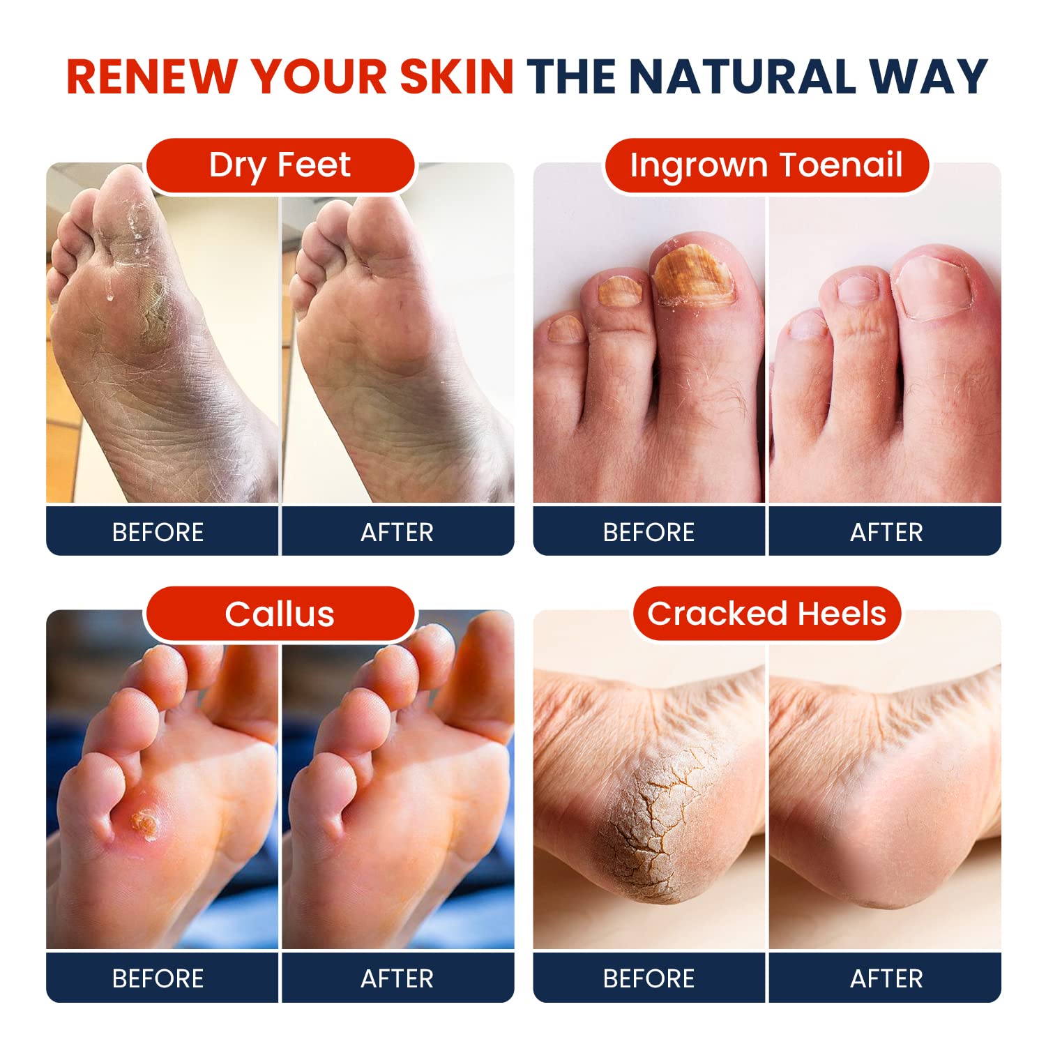 Muscle Relief Foot Soak with Epsom Salts - All Natural Salts for Post Workout Recovery FOOT CURE buy supplements canada