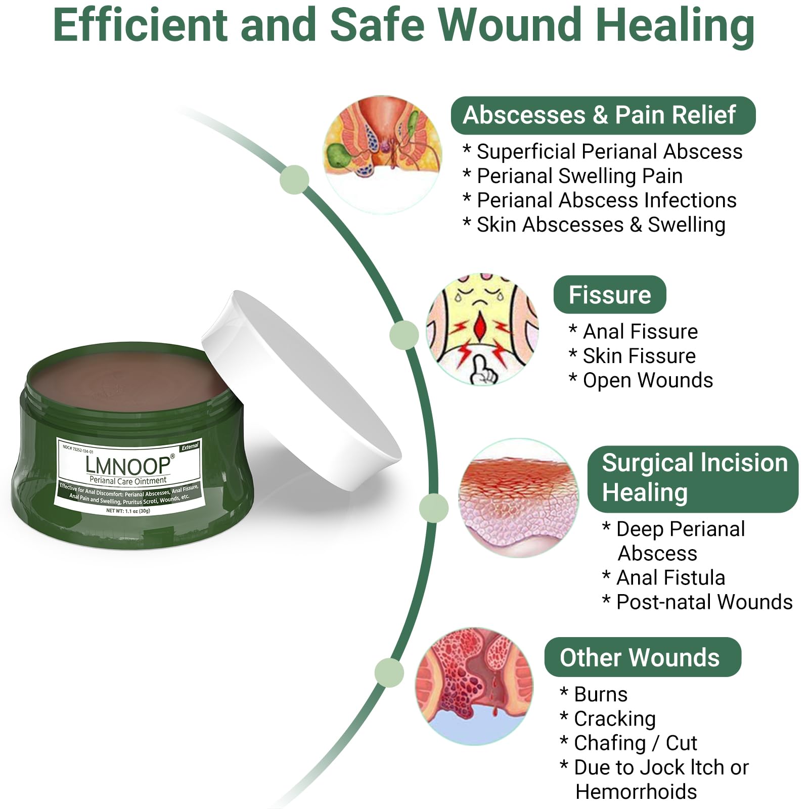 LMNOOP Perianal Repair Ointment: Treatments for Anal Fistula, Anal Fissure, Perianal Abscess, Rapid Relief from Pain, Burning, Itching, Swelling, Bleeding, and Discomfort by Jock Itch or Hemorrhoids LMNOOP buy supplements canada