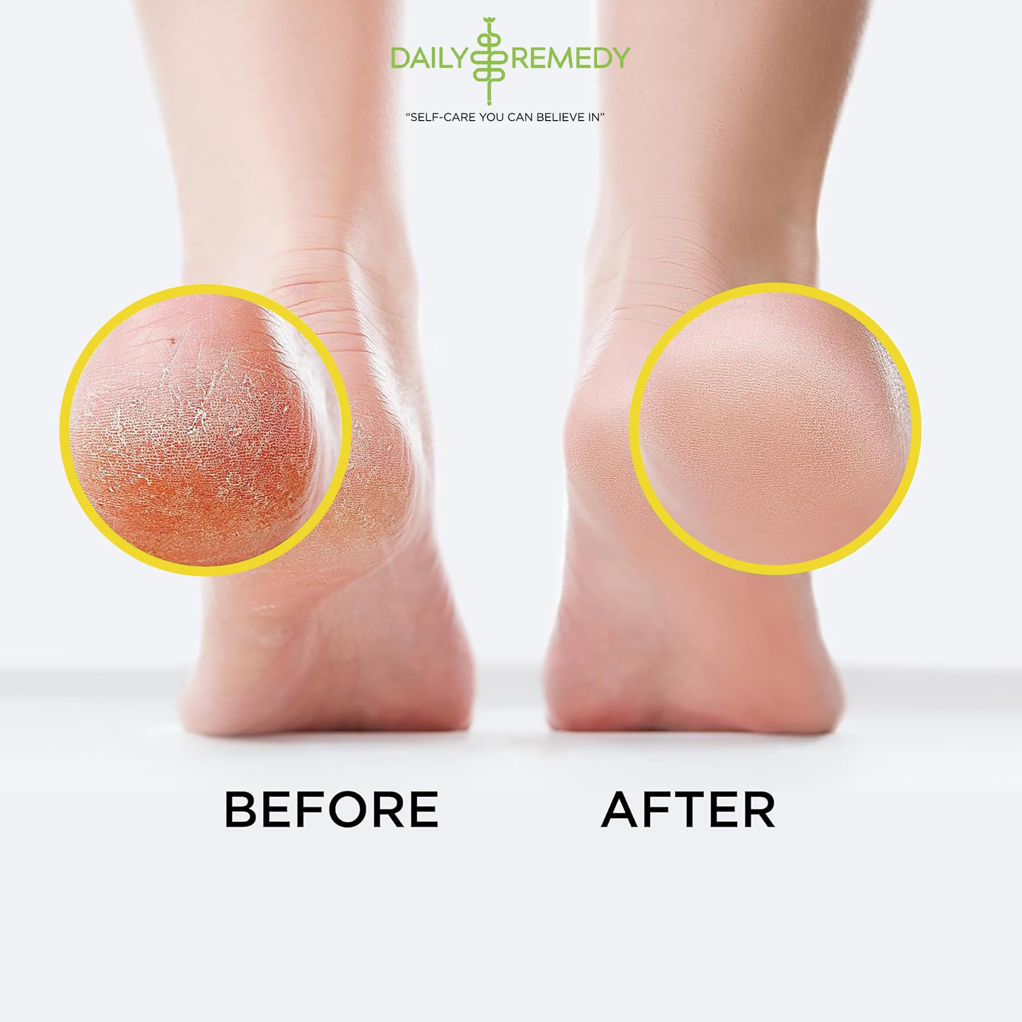 Citrus Detox Foot Soak with Epsom Salt - for Foot Callus, Immune Boost, Damaged Toenail DAILY REMEDY buy supplements canada