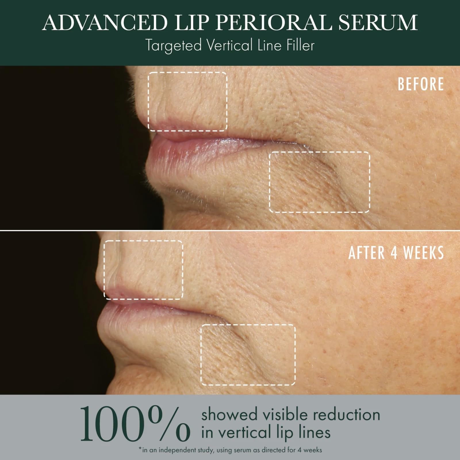 RéVive Advanced Perioral Lip Serum - Anti Aging Perioral Lip Treatment to Reduce Lip Area Lines & Wrinkles -Helps Restore Lip Contour & Visible Fullness(0.5 fl oz) RéVive buy supplements canada