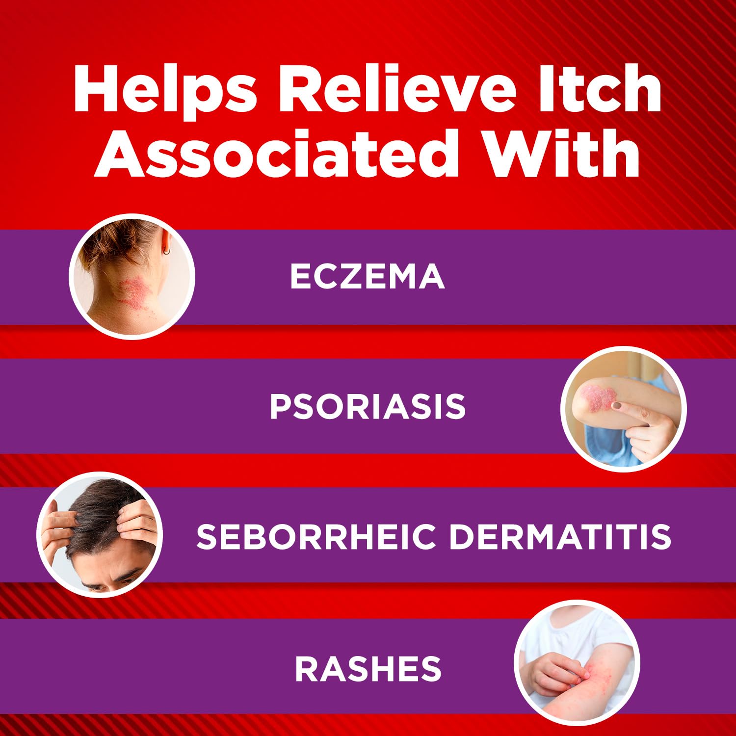 Cortizone-10 Maximum Strength Intensive Healing Itch Relief Lotion for Eczema, 1% Hydrocortisone, Fast-Acting, Anti-Itch Cream for Minor Skin Irritations, Rashes and Inflammation Due to Eczema, 3.5 oz Cortizone 10 buy supplements canada