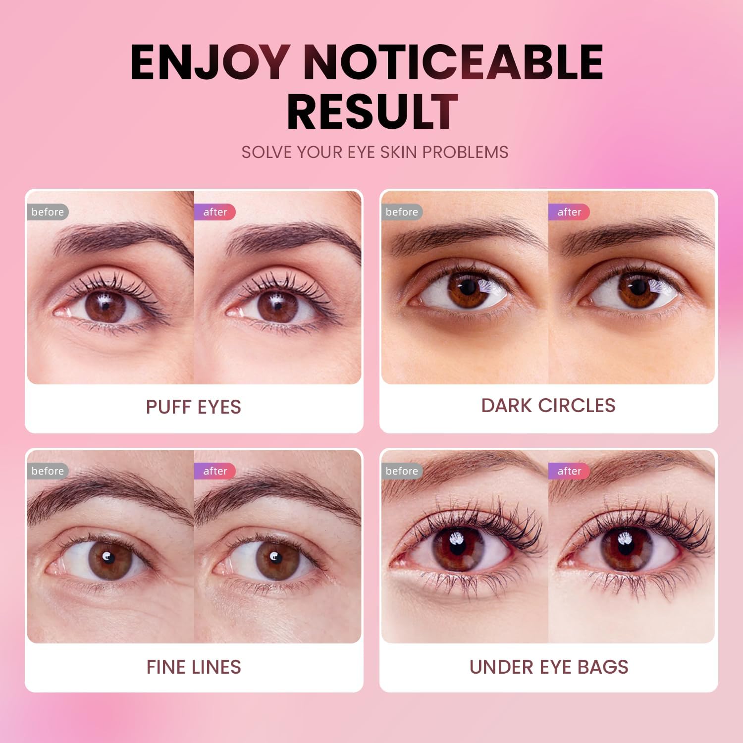 AILEORY Under Eye Patches (24 Pairs) - Tri-color Glitter Eye Gel Pads for Dark Circles, Puffy Eyes, Under eye Bags, Wrinkles AILEORY buy supplements canada