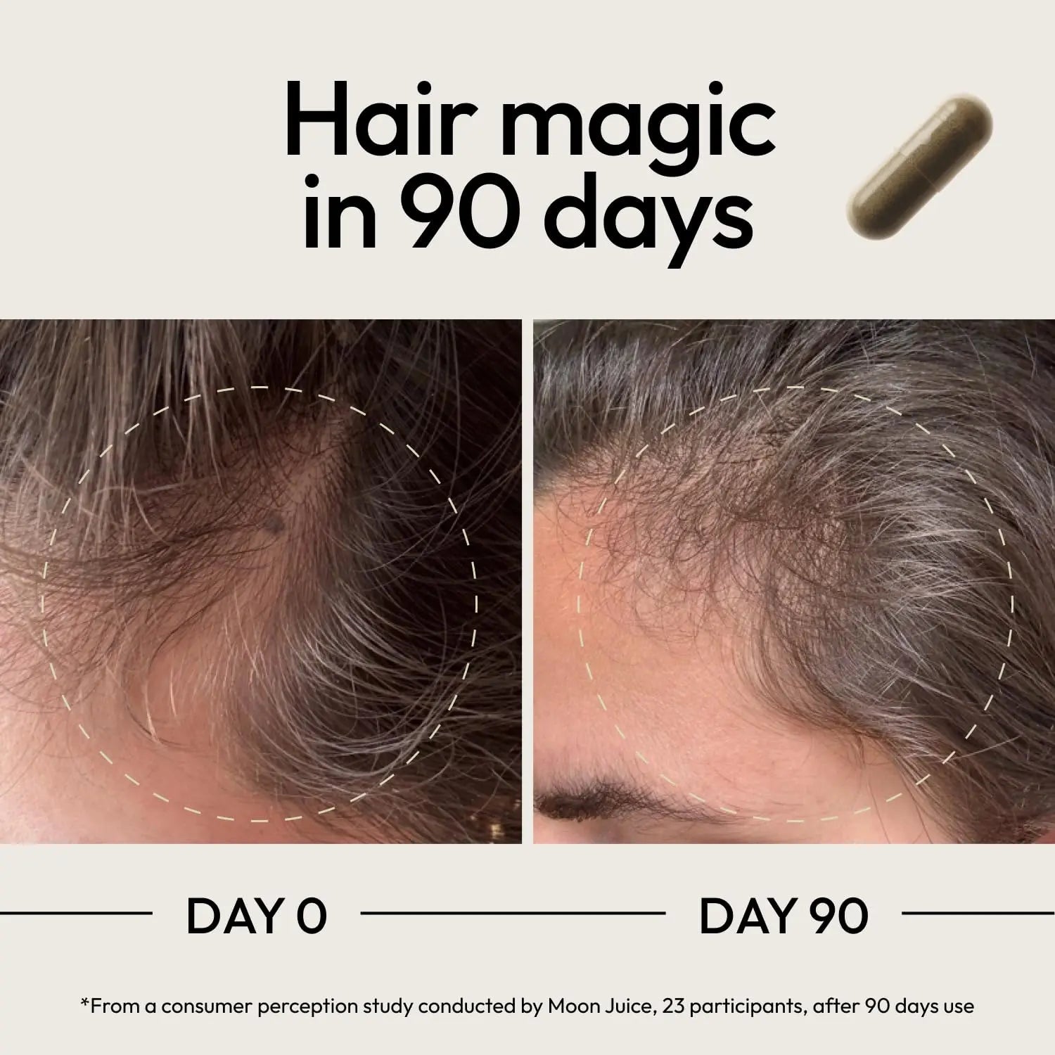 Moon Juice SuperHair Hair Growth Vitamins for Women & Men with Biotin & Saw Palmetto - Clinical Strength Multivitamin Hair Supplement Moon Juice buy supplements canada