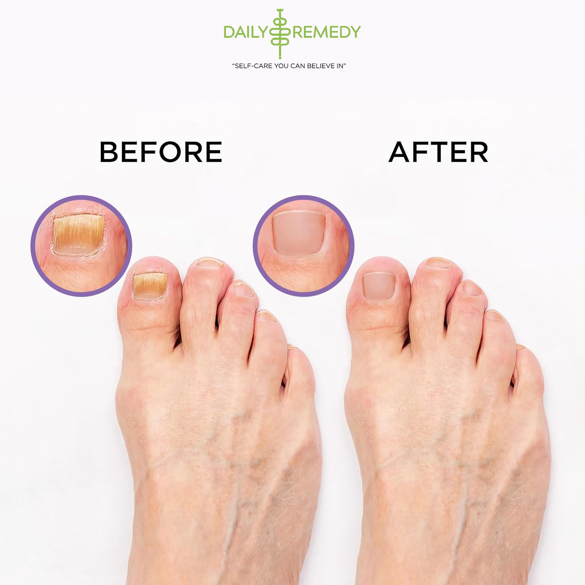 Calming Lavender Foot Soak with Epsom Salt, Made in USA, Foot Soak Soothes Sore Tired DAILY REMEDY buy supplements canada