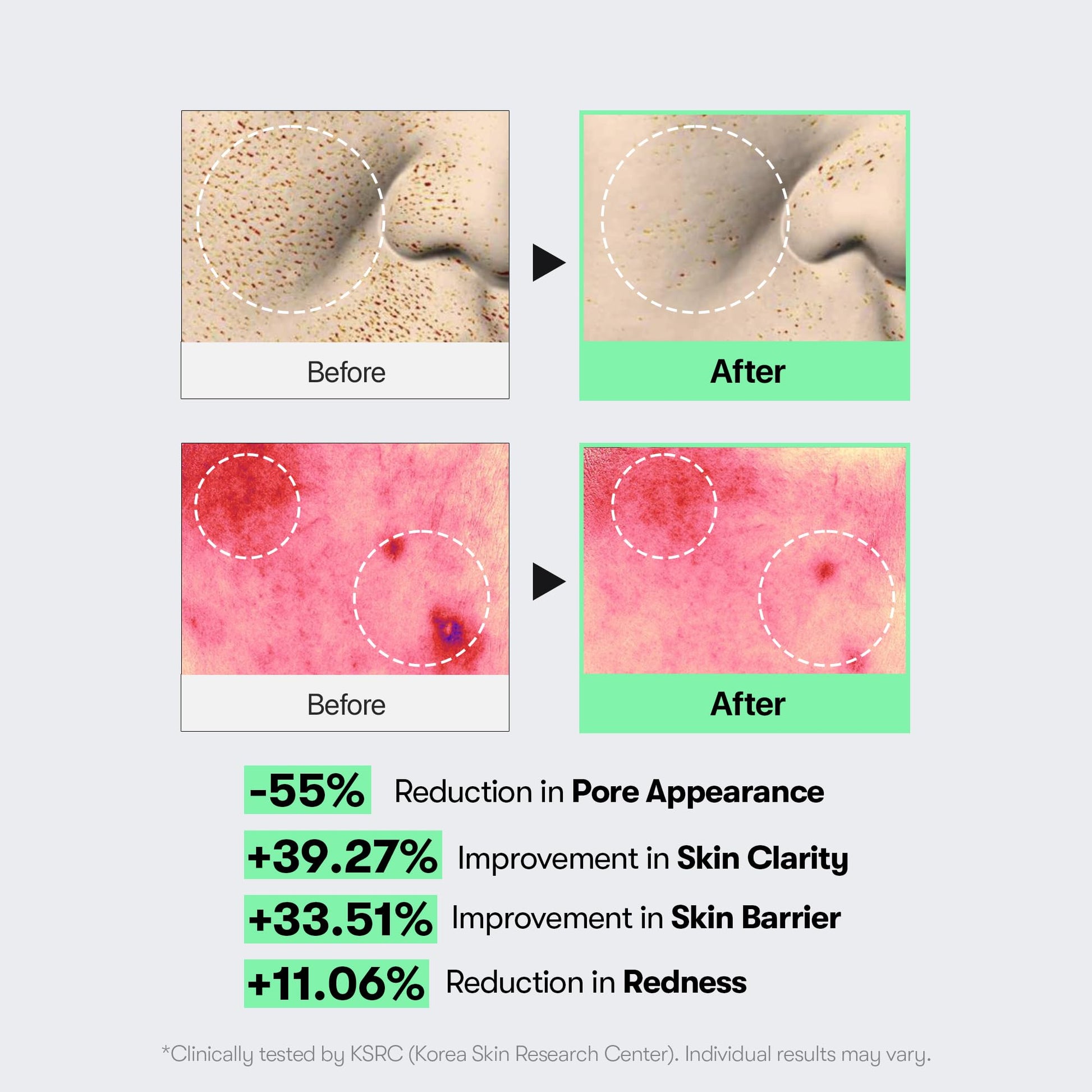 VT COSMETICS CICA Reedle Shot 100, Spicule Microneedling Serum for Pore Care & Exfoliation, Exosome, Centella Asiatica for Glass Skin VT COSMETICS buy supplements canada