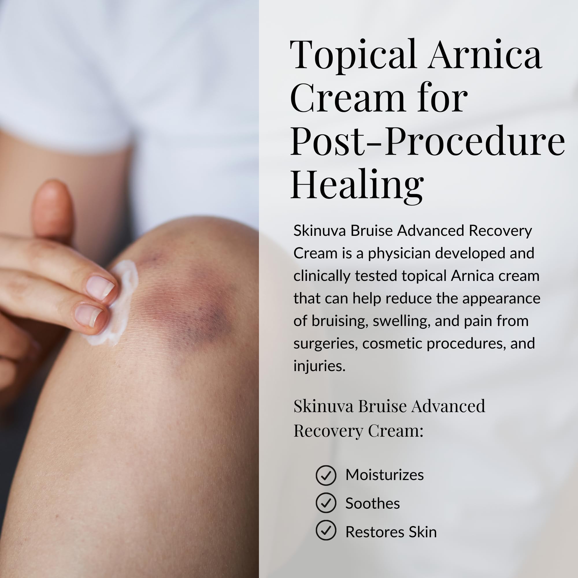 Skinuva® Bruise Advanced Recovery Cream - Topical Bruise Cream Formulated with Growth Factors, Arnica & Vitamin K (1 oz) Skinuva buy supplements canada