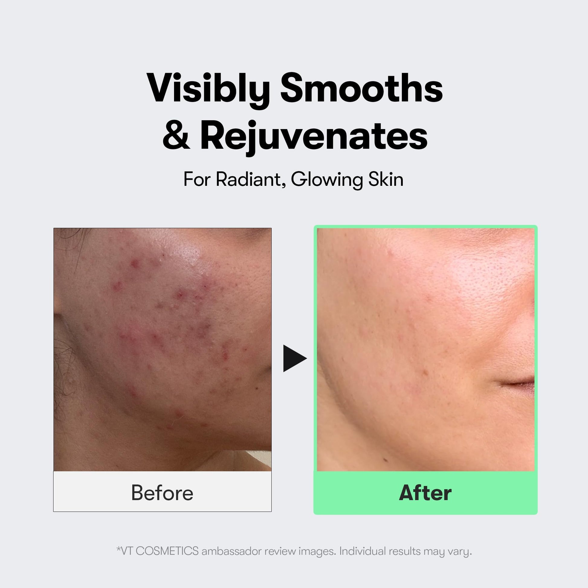VT COSMETICS CICA Reedle Shot 100, Spicule Microneedling Serum for Pore Care & Exfoliation, Exosome, Centella Asiatica for Glass Skin VT COSMETICS buy supplements canada