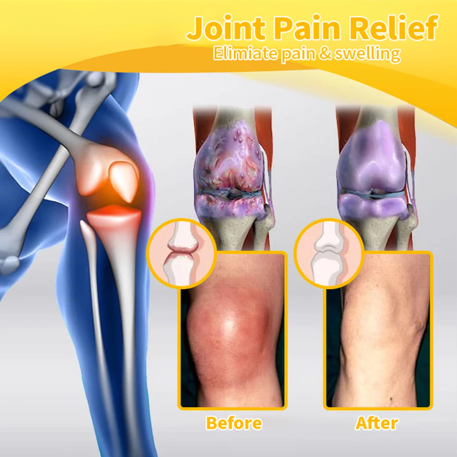 Luhaka Botulinum Toxin & Bee Venom Pain-Relief Bone Healing Cream,Bee Venom Cream,Effectively improve joint mobility (1PC) Luhaka buy supplements canada