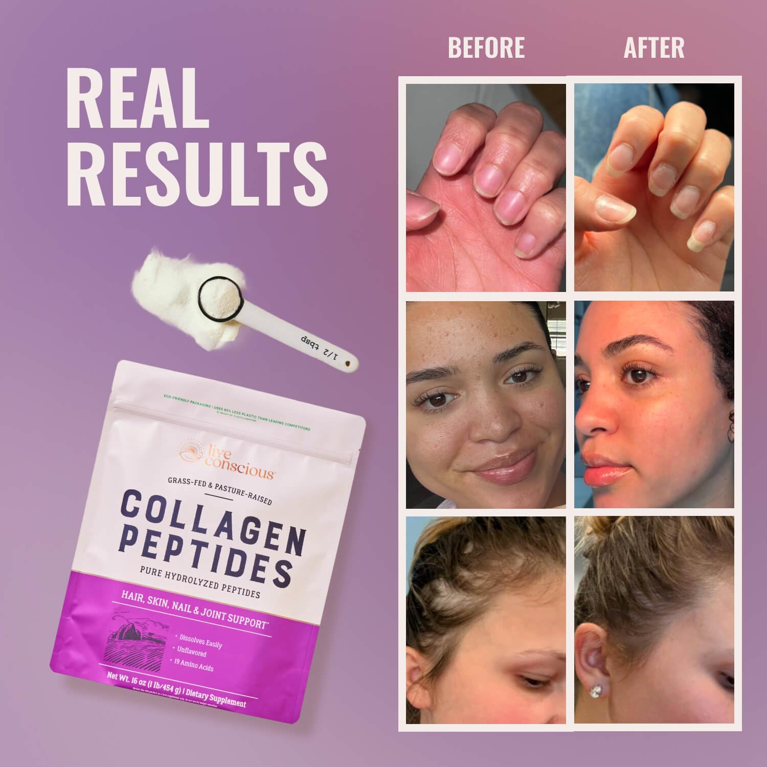 Live Conscious Collagen Peptides Powder - Naturally-Sourced Hydrolyzed Collagen Powder - Hair, Skin, Nail, and Joint Support - Type I & III Grass-Fed Collagen Live Conscious buy supplements canada