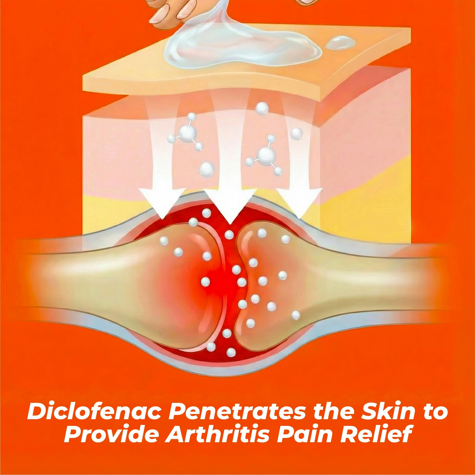 Aspercreme Arthritis Pain Relief Gel for Arthritis & Joint Pain, Non-steroidal Anti-inflammatory Topical Gel with Max-Strength Diclofenac Sodium, 100 g Aspercreme buy supplements canada