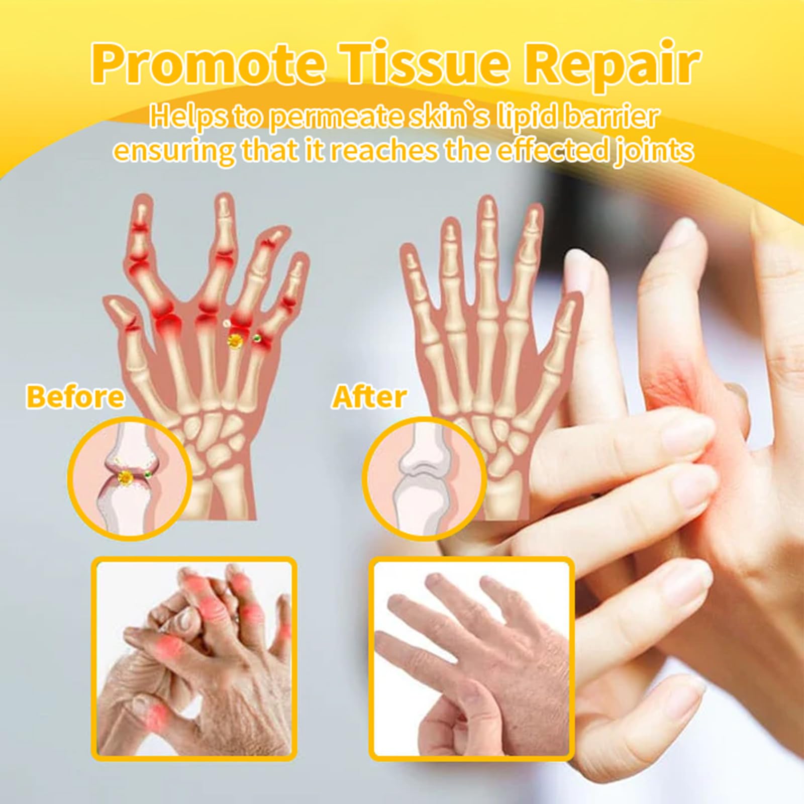 Luhaka Botulinum Toxin & Bee Venom Pain-Relief Bone Healing Cream,Bee Venom Cream,Effectively improve joint mobility (1PC) Luhaka buy supplements canada