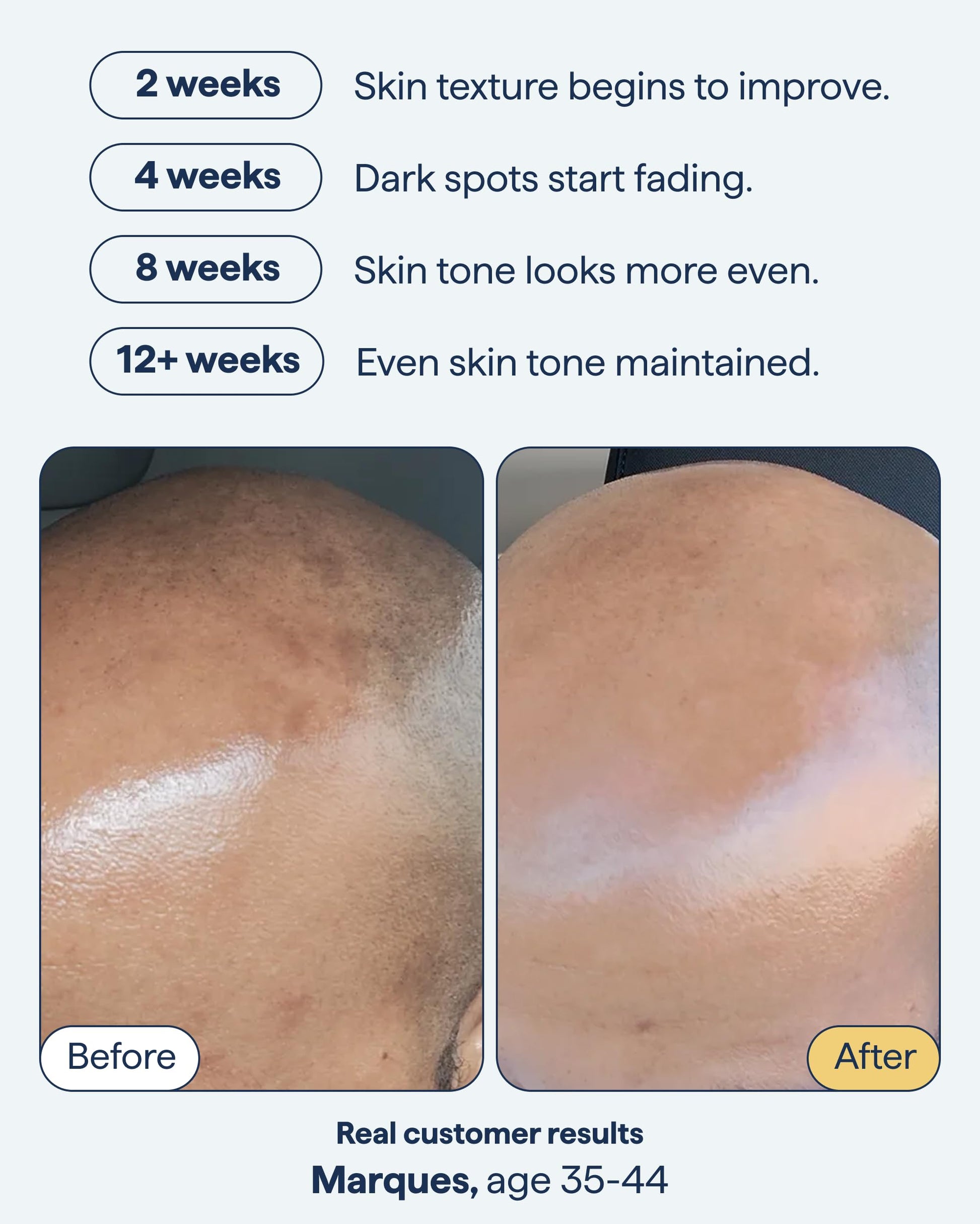 Remedy for Dark Spots | Advanced Night Treatment with Retinol & Kojic Acid | For Discoloration and Uneven Tones | With Glutathione Remedy Science buy supplements canada