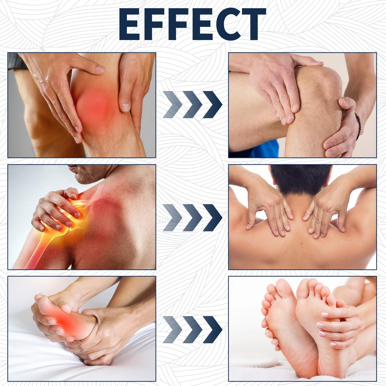 YIVANNUO 2PCS Neuropathy Relief Cream, Contains Arnica, Menthol, Msm, and Glucosamine, Suitable for Feet, Hands, Legs, Muscles, Joints, and Waist, Fast Absorption, Mild & All Natural YIVANNUO buy supplements canada