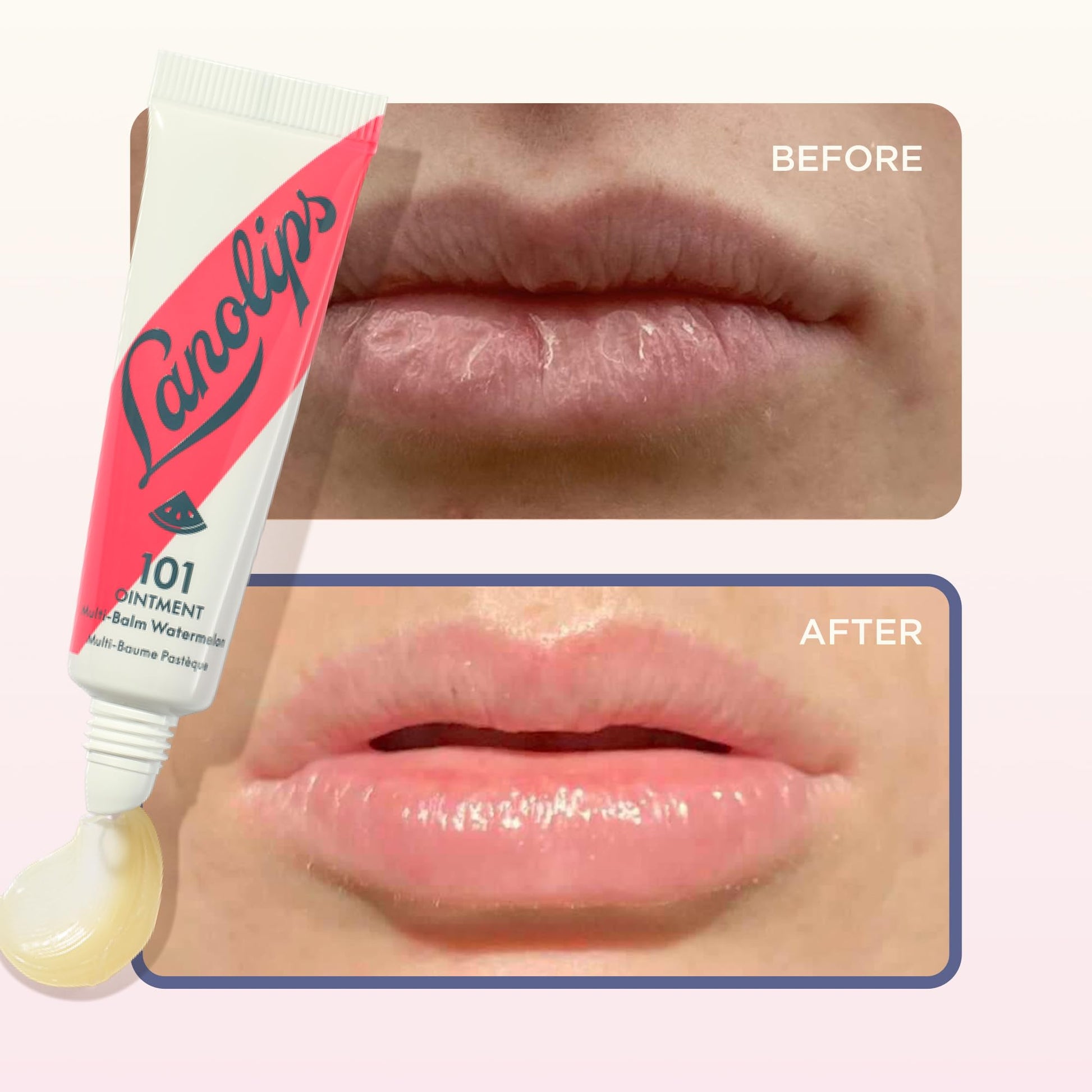 Lanolin 101 Multipurpose Ointment - Lanolin Lip Balm & Healing Ointment for Skin Barrier Repair - Moisturizer for Dry Lips, Cuticles & Elbows - No Petroleum Formula - Watermelon (0.35 oz) Lanolips buy supplements canada
