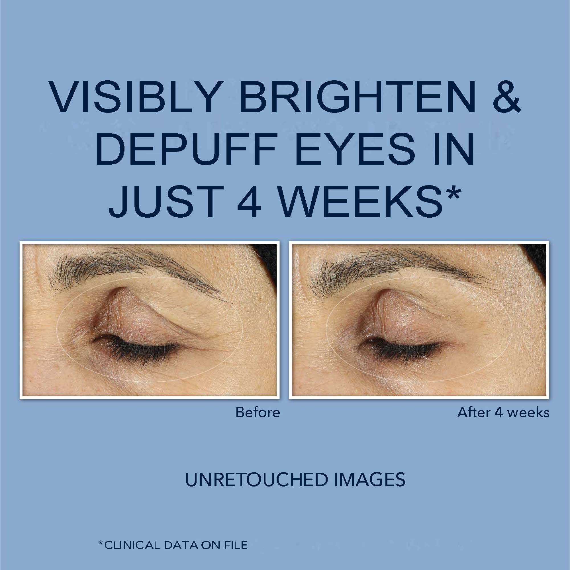 RoC Retinol Correxion Eye Cream Mini for Dark Circles & Puffiness, Daily Wrinkle RoC buy supplements canada