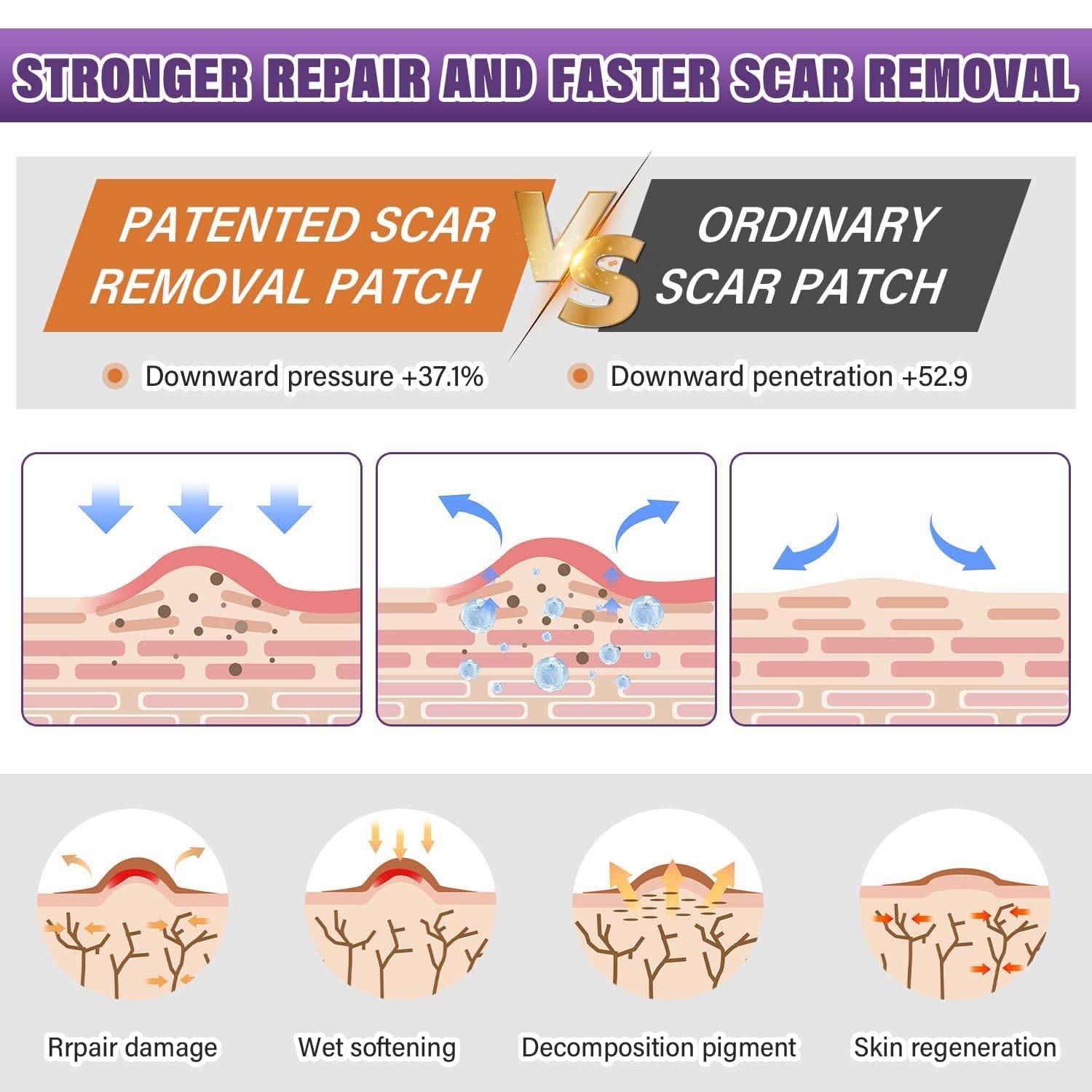 Silicone Scar Sheets,Silicone Scar Tape,Silicone Scar Removal Strips for Surgical,C-Section,Tummy Tuck,Keloid Scars Psecici buy supplements canada