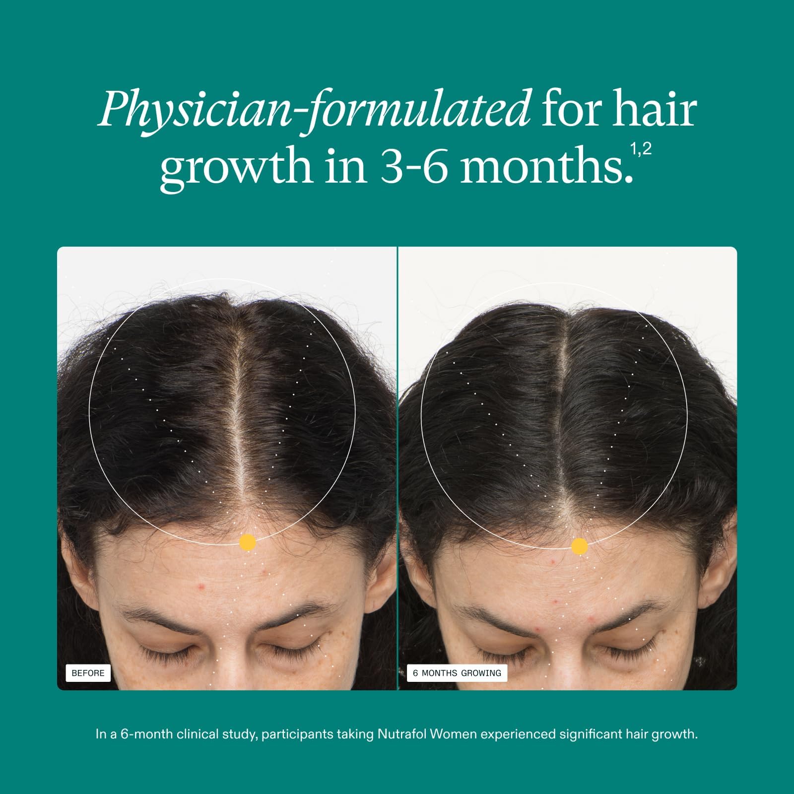 Nutrafol Women's Hair Growth Supplements, Ages 18-44, Clinically Proven for Visibly Thicker and Stronger Hair, Dermatologist Recommended - 1 Month Supply Nutrafol buy supplements canada
