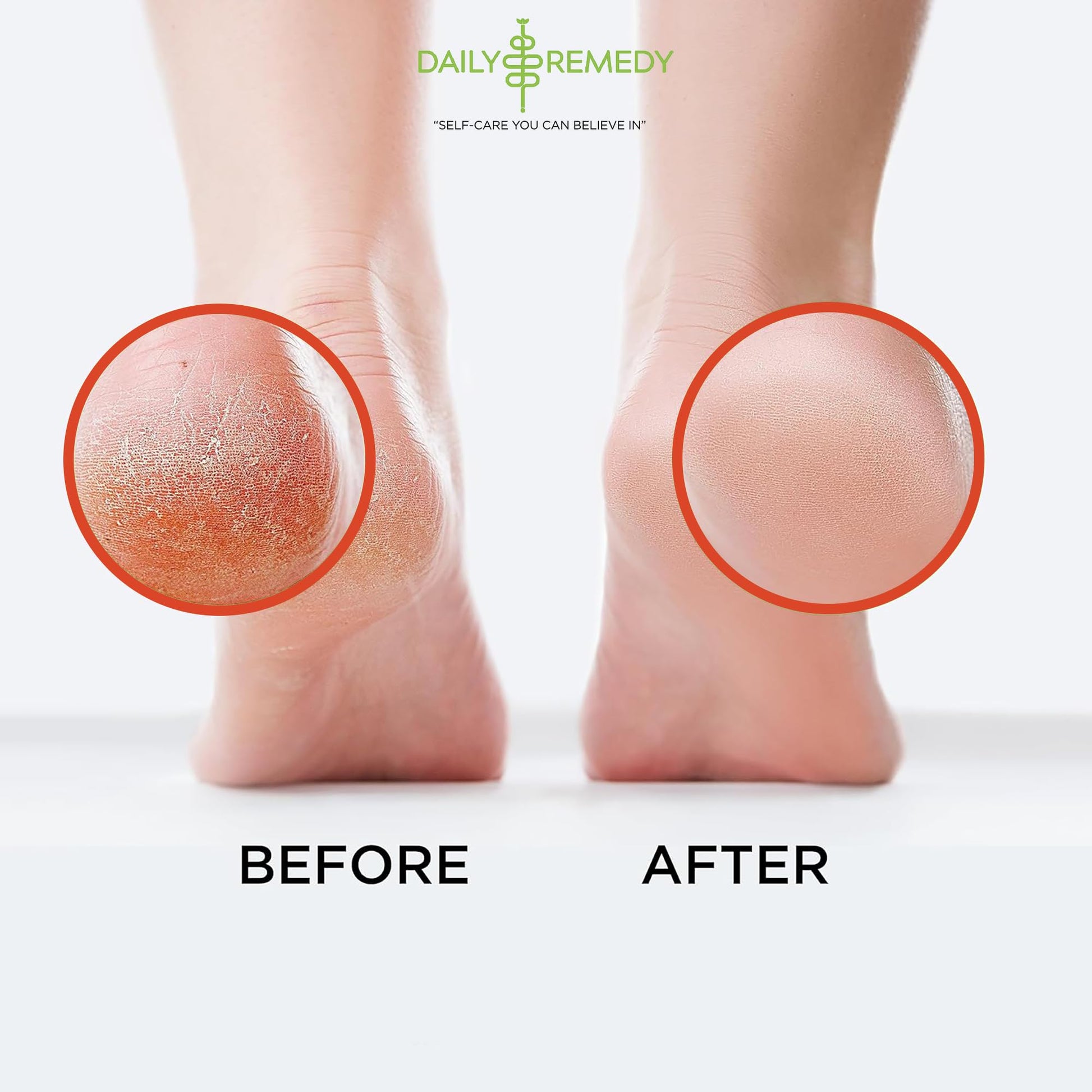 Muscle Relief Foot Soak with Epsom Salt, Made in USA, Soothe Foot Aches, Muscle Pain DAILY REMEDY buy supplements canada