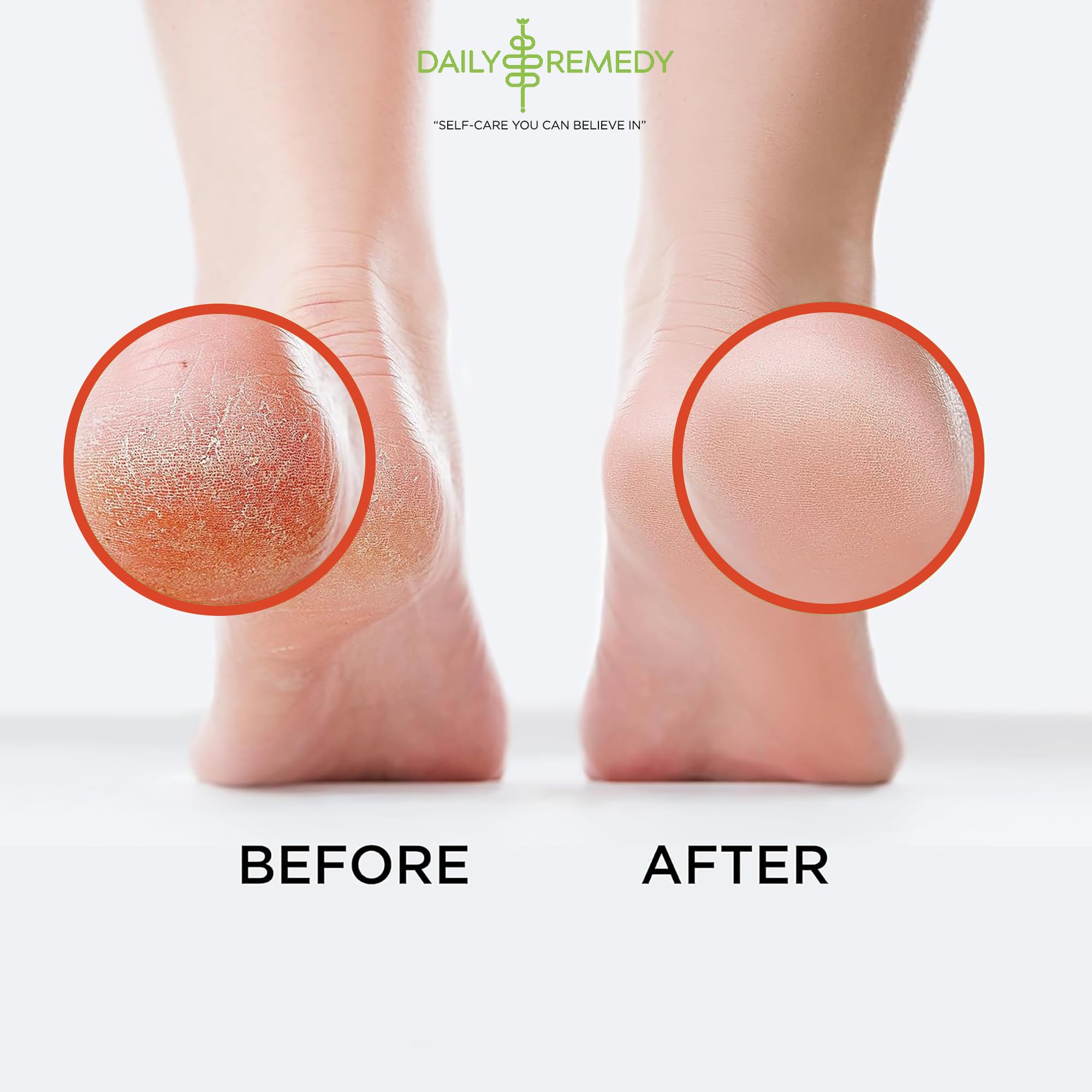 Muscle Relief Foot Soak with Epsom Salt, Made in USA, Soothe Foot Aches, Muscle Pain DAILY REMEDY buy supplements canada