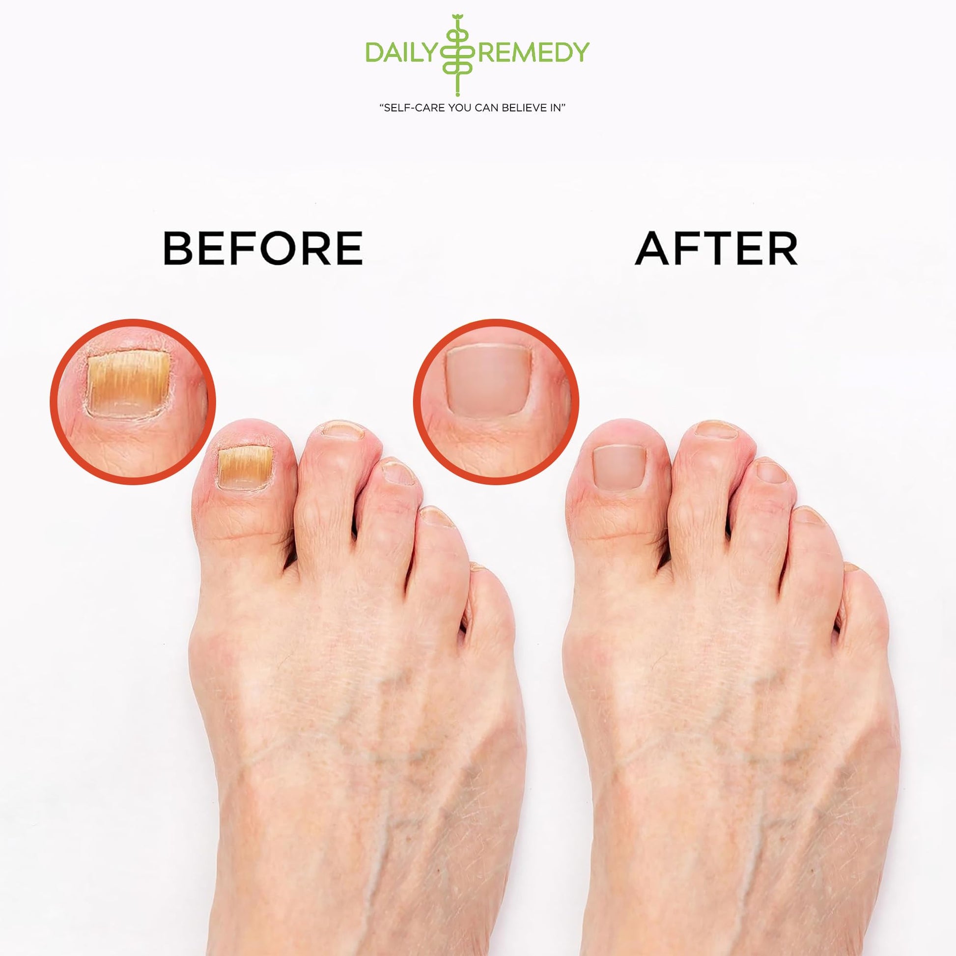 Muscle Relief Foot Soak with Epsom Salt, Made in USA, Soothe Foot Aches, Muscle Pain DAILY REMEDY buy supplements canada