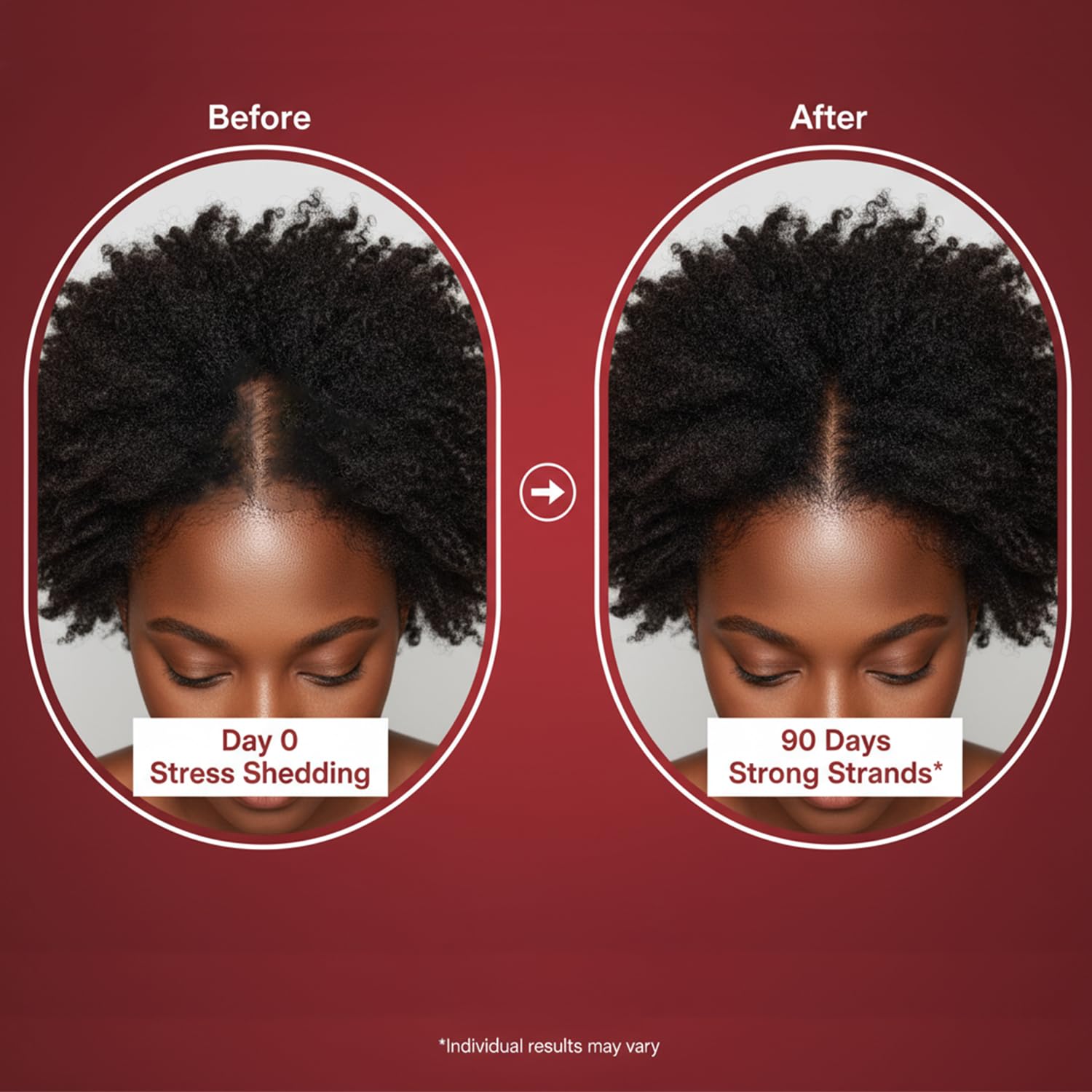 Lumin Hair Growth Gummies for Black Women, 60 Vegan Gummies, Daily Hair Nourishment with Biotin, Collagen & Botanical Extracts, Supports Healthy Hair Growth & Strength Lumin Hair buy supplements canada