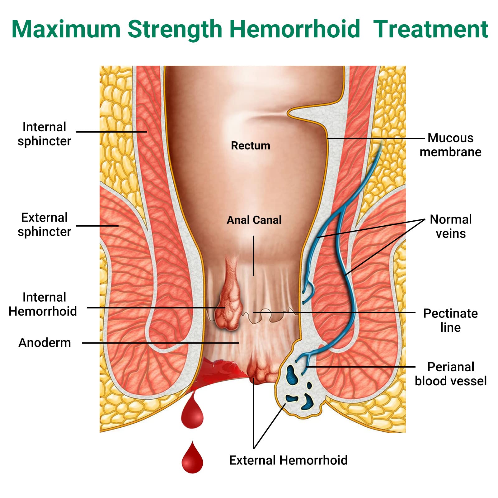 Hemorrhoid Treatment Ointment, Maximum Strength Treatment & Fast Relief for Pain, Itching, Burning, Swelling, Fissure, Bleeding, Discomfort, Long-Lasting Internal & External Hemorrhoid Cream, (2-Pack) LMNOOP buy supplements canada
