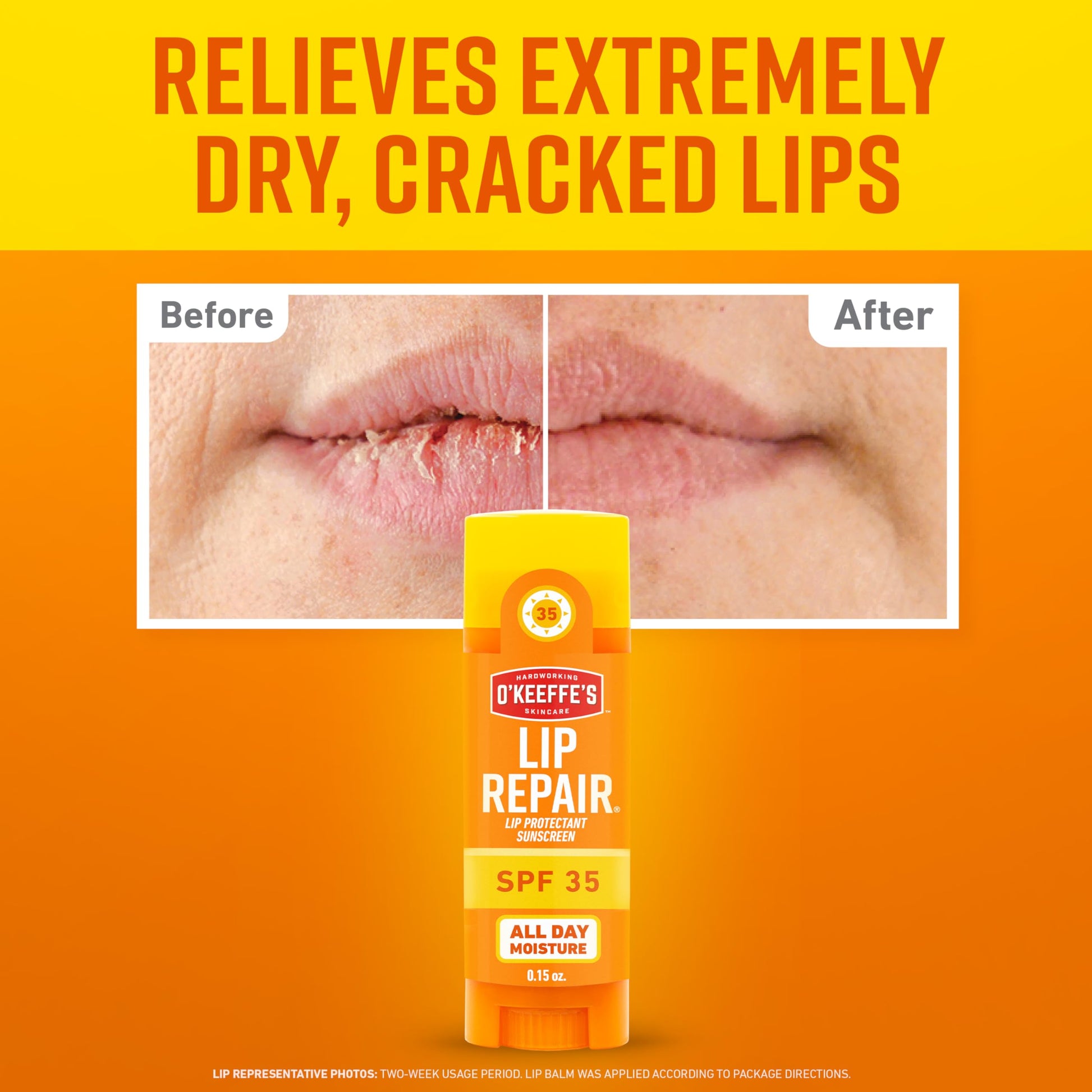 O'Keeffe's Lip Repair SPF 35 Lip Balm - Stick (3 Pack) - Sun-Safe Moisturizer for Extremely Cracked, Dry Lips O'Keeffe's buy supplements canada