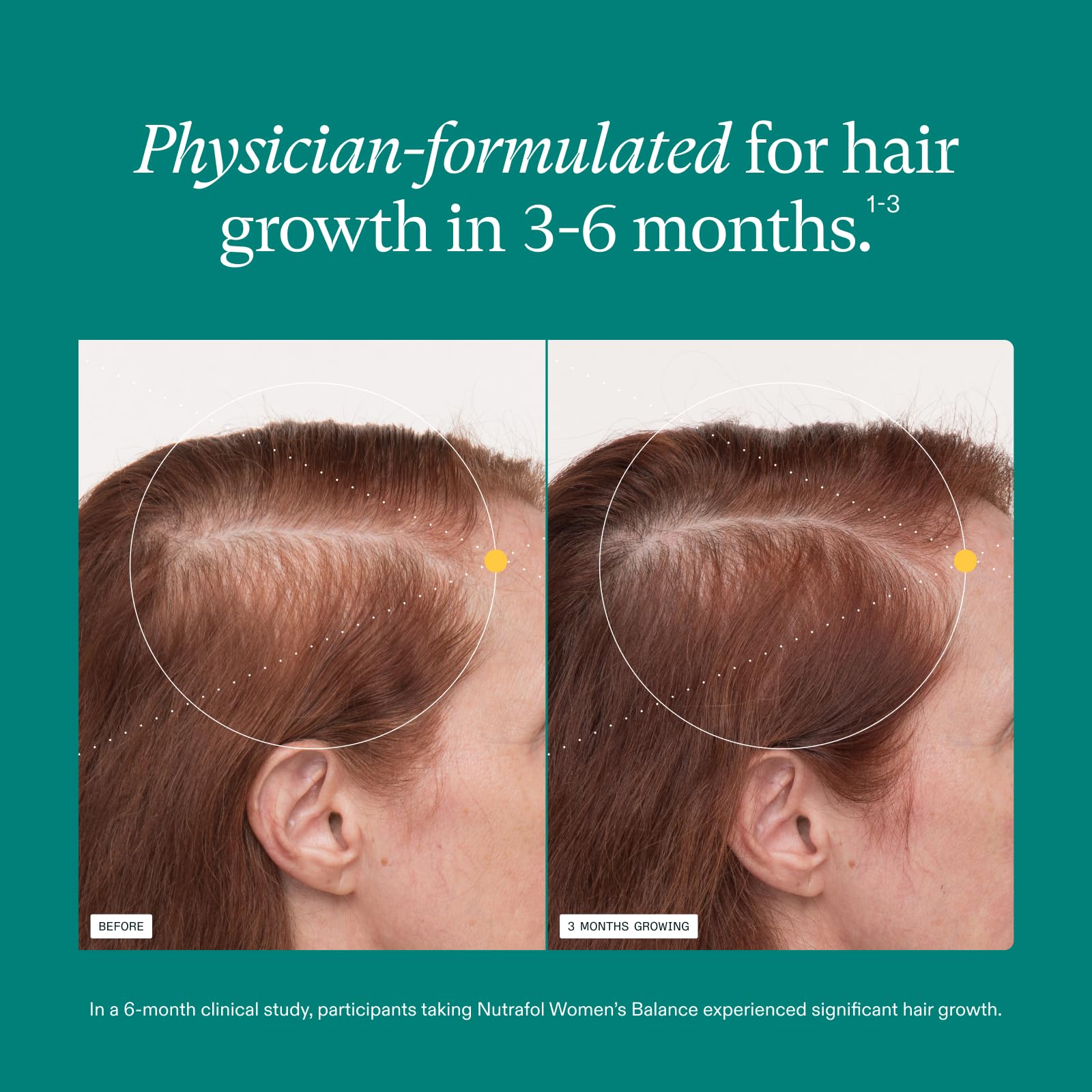 Nutrafol Women's Balance Hair Growth Supplements, Ages 45 and Up, Clinically Proven for Visibly Thicker Hair and Scalp Coverage, Dermatologist Recommended - 1 Month Supply Nutrafol buy supplements canada