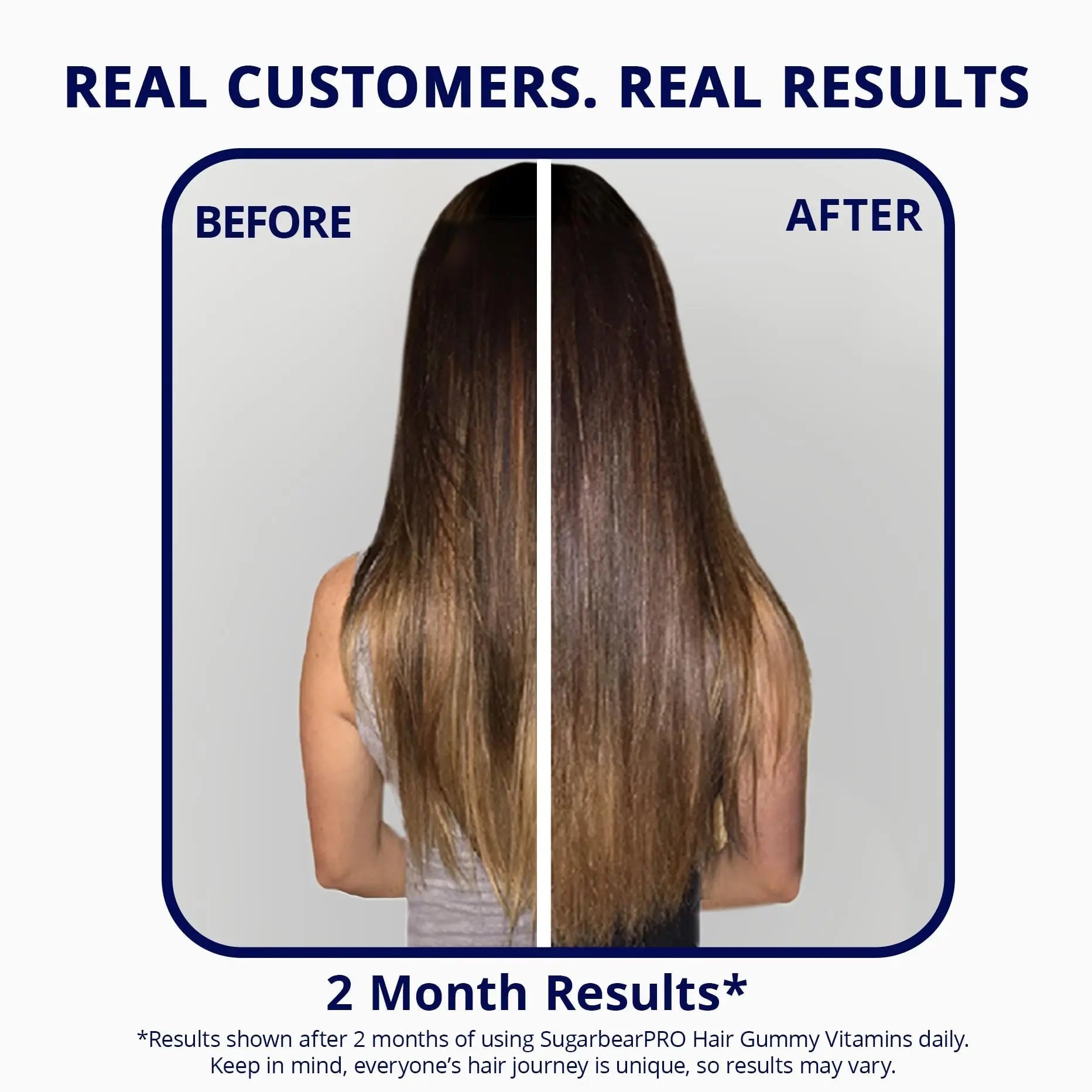 SugarBearPro Hair Vitamin Gummy 3 Month Supply Extra Strength Biotin 6000mcg, Growth for Men & Women, Vegan Vitamin B12 SugarBearHair buy supplements canada
