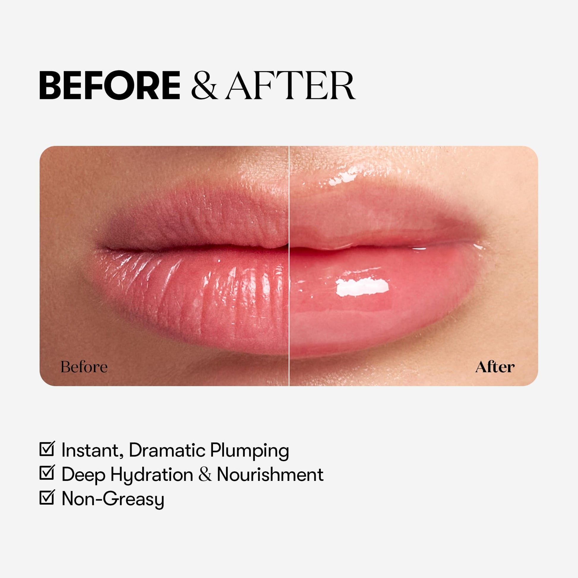 VTCOSMETICS Reedle Shot Lip Plumper, 0.15 oz (4.3 g), Moisturizing, Transparent, Lip Gloss, Fragrance-free, Korean Cosmetics (Expert) VT COSMETICS buy supplements canada