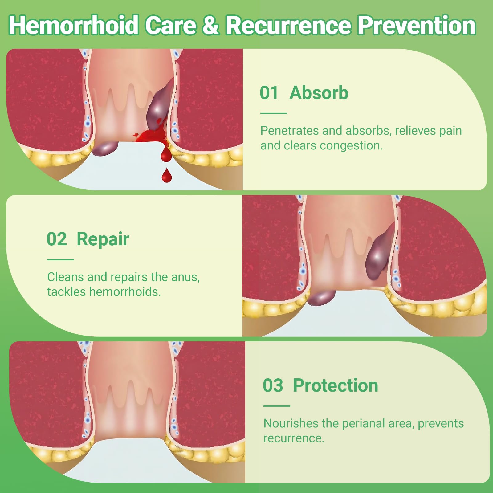 Hemorrhoid Treatment Ointment - Tubesmaximum Strength - Fast Relief from Pain, Itching, Burning, Swelling & Fissures | Natural Aloe & Vitamin E | Travel-Friendly10g x 5 Pieces Tubes - (1.76 Oz) yimimde buy supplements canada
