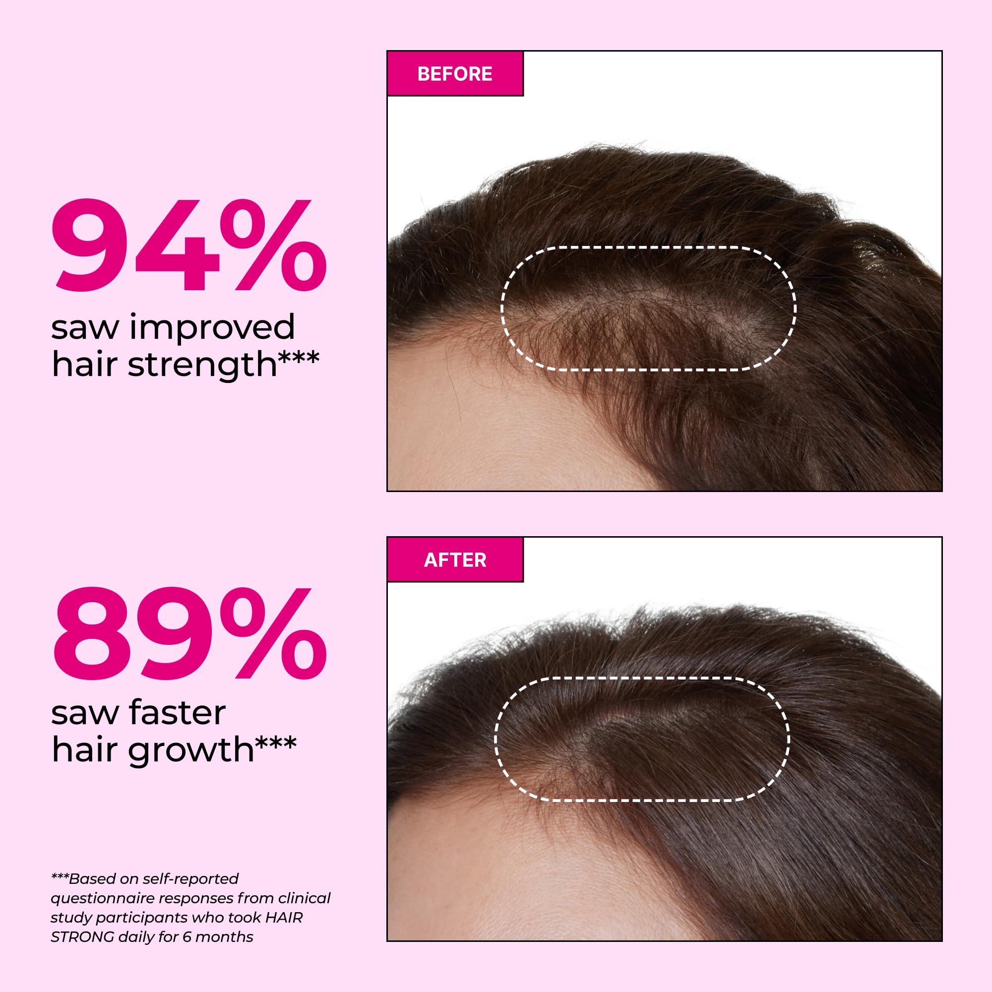 HUM Hair Strong Daily Hair Growth Gummies with Biotin, Zinc, Vitamin B12 to Support Growth, Folic Acid & Vitamin B12 Gummy Vitamins for Healthy Hair Support for Women and Men, 60 Gummies HUM buy supplements canada