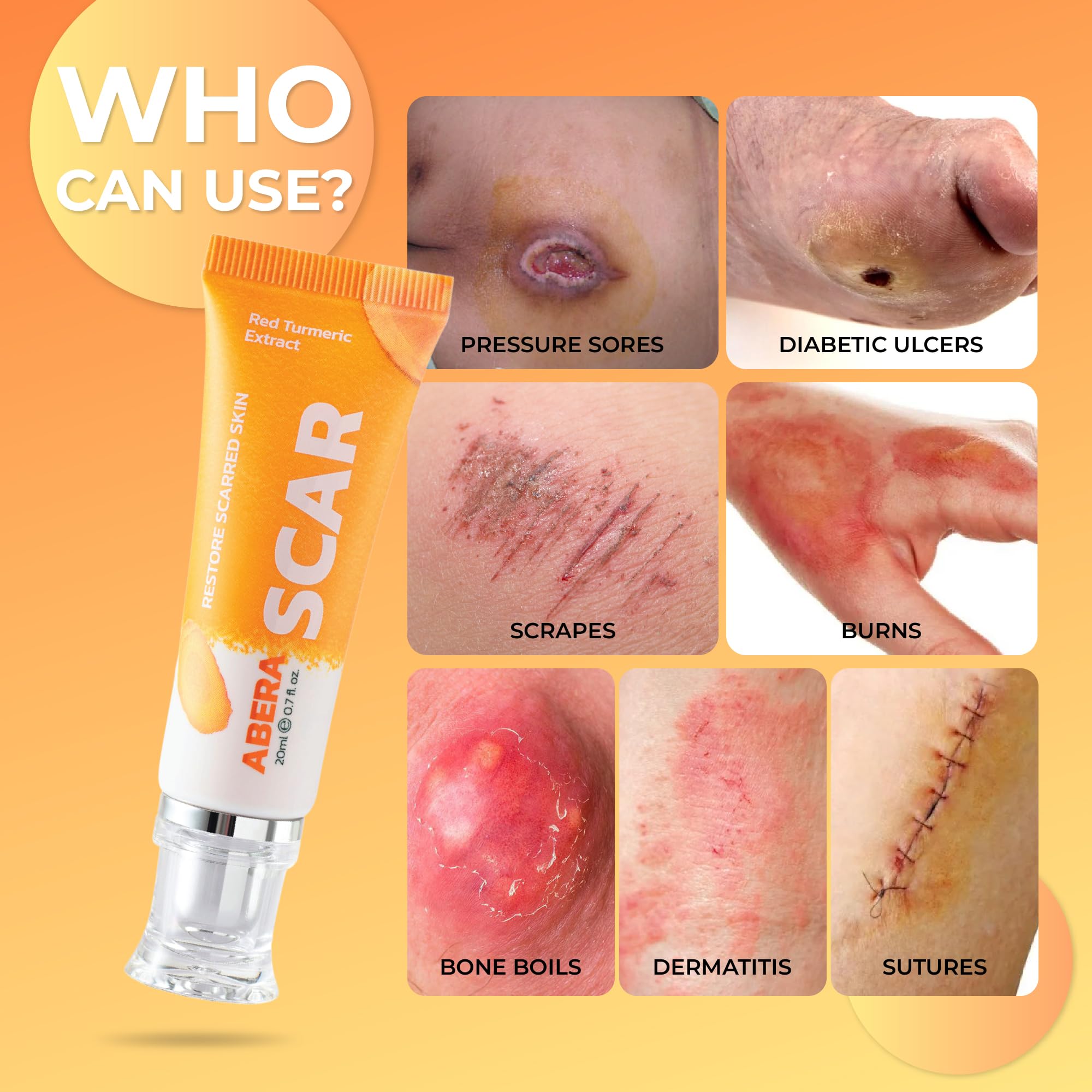 ABERA Scar Removal Cream for Women and Men - Rapid Repair of New Old Scars, Spots, Burns All Natural Treatment with Vitamin E, Alanine, Collagen (1 Box + 3 Eye Patch) ABERA buy supplements canada