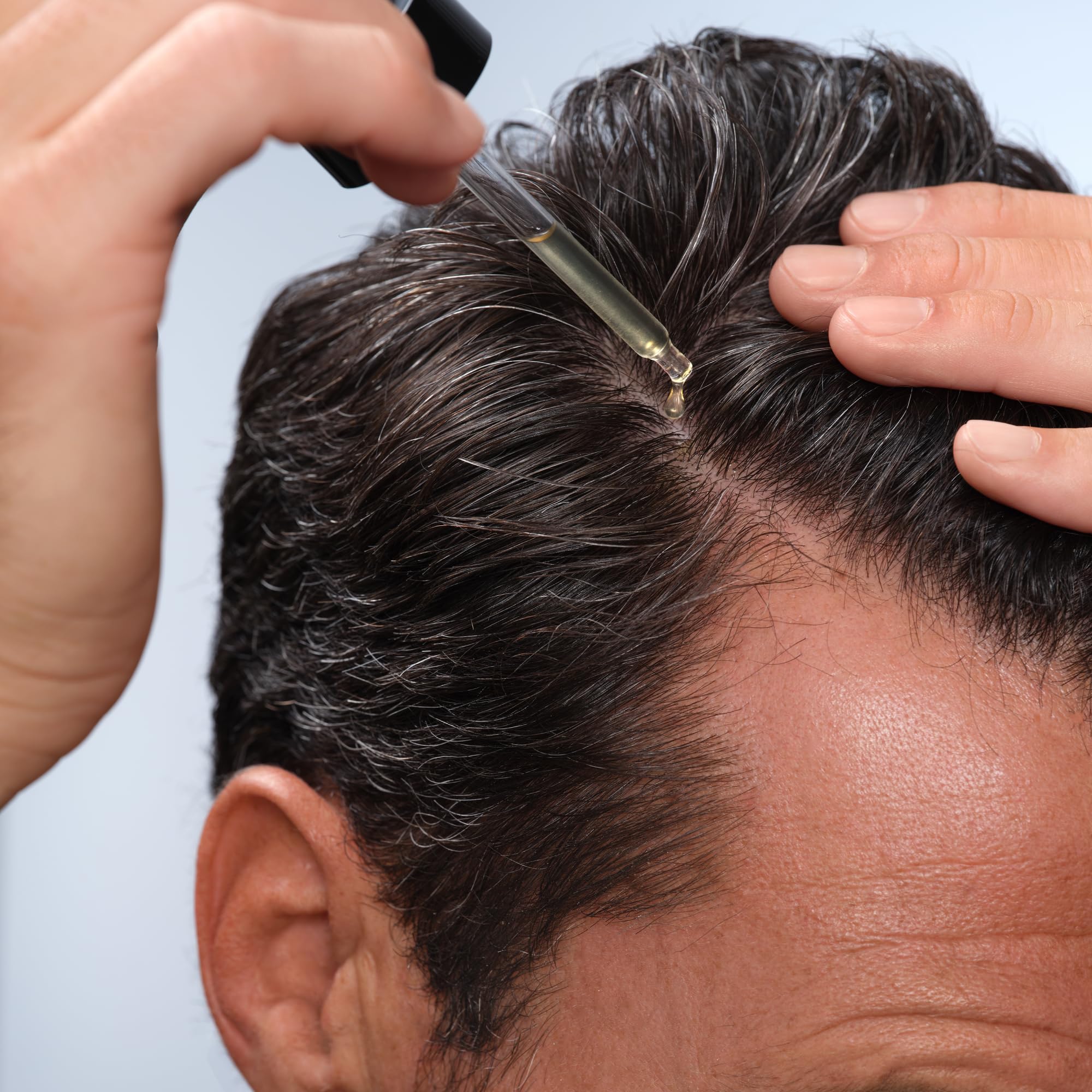 Caldera + Lab The Hair Serum | Men’s Thickening Serum for Thinning & Receding Hair, Supports Fuller & Stronger-Looking Hair, Dermatologically Tested - All Hair Types Caldera + Lab buy supplements canada