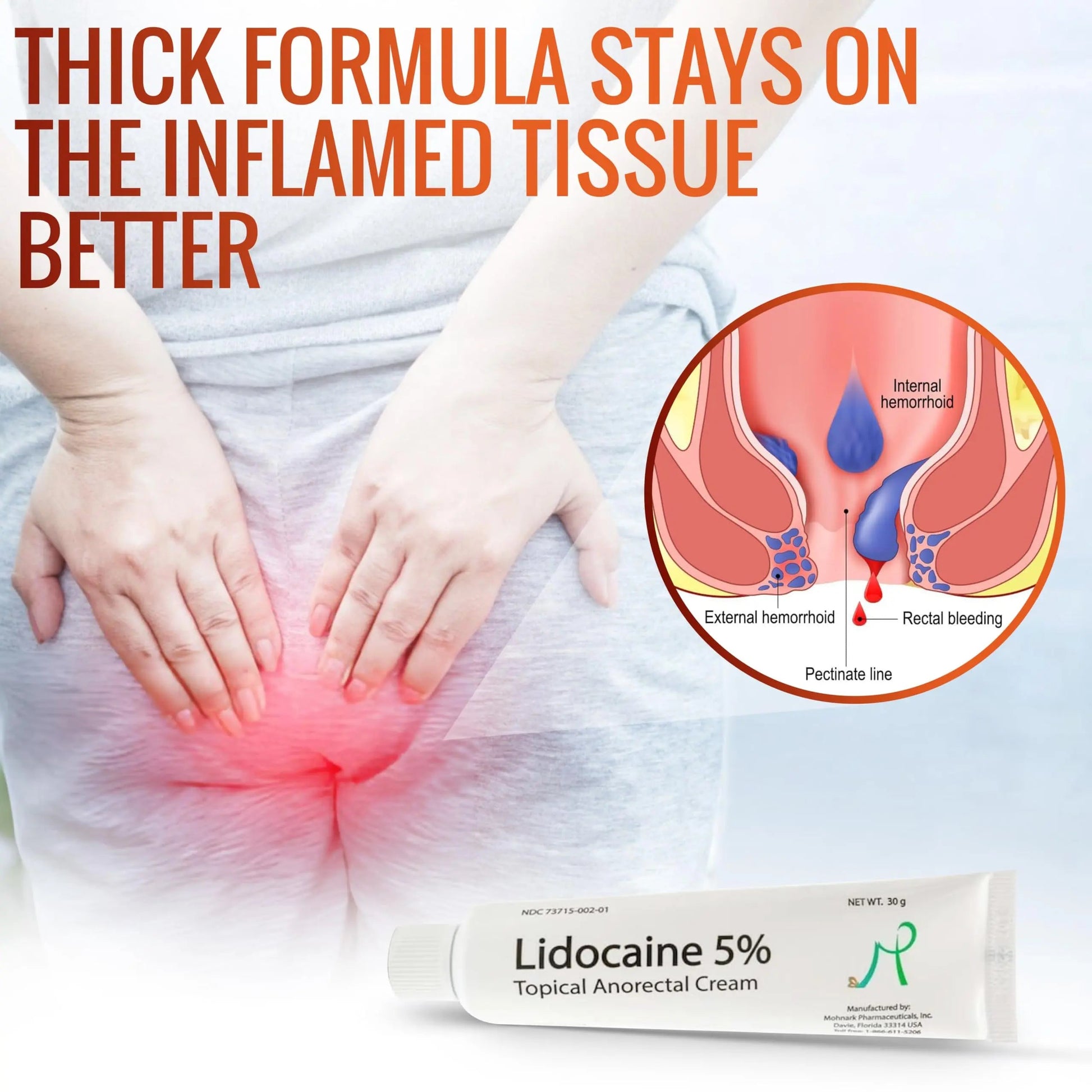 Mohnark Maximum Strength Lidocaine Hemorrhoid Treatment Cream for External and Internal Hemorrhoids Treatment Burn Itch Pain Relief Anal Cream Topical Anorectal Numbing Cream- 30 Gram Tube Made in USA MOHNARK buy supplements canada
