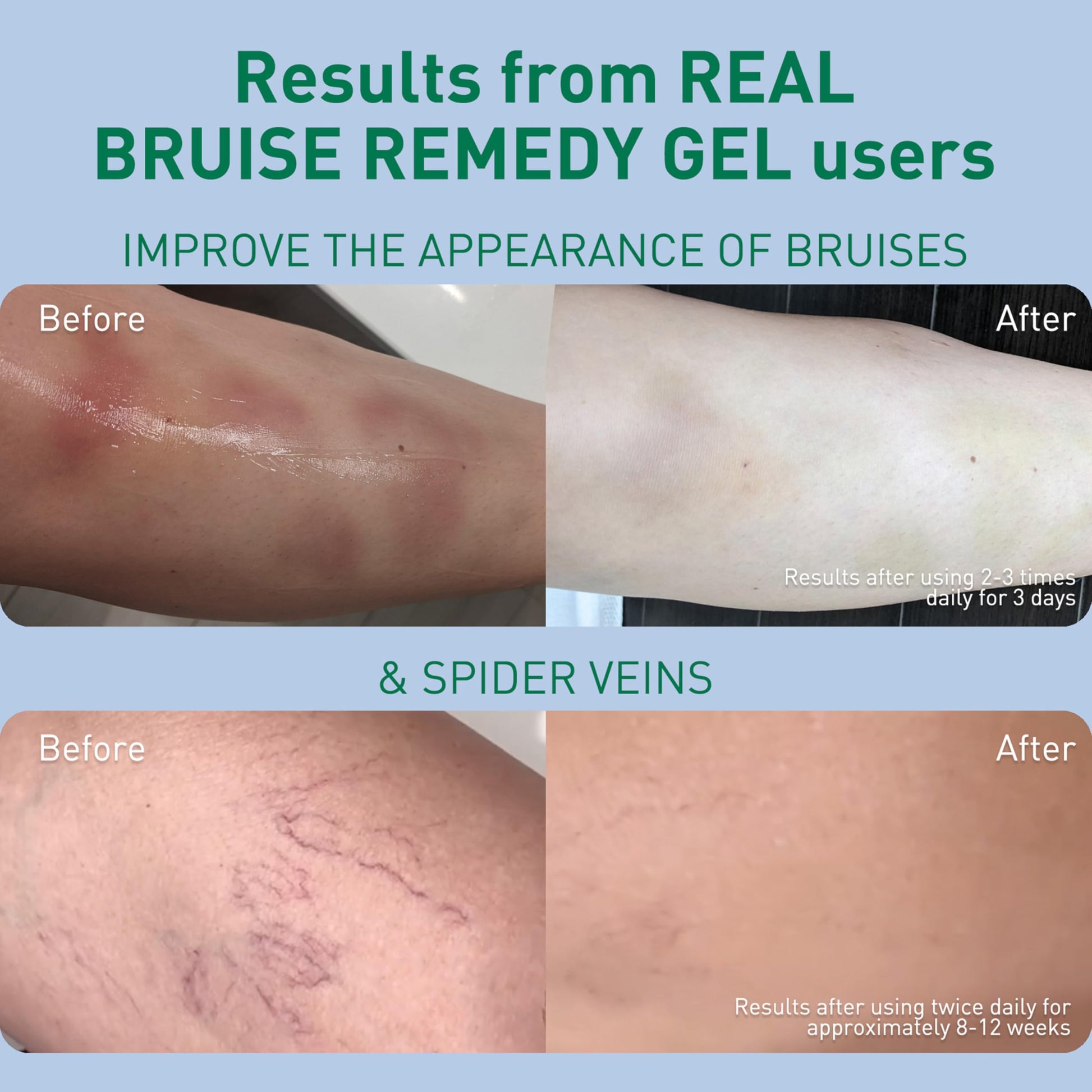 PROcure Arnica & MSM Bruise Remedy Gel – Paraben-Free, Unscented Arnica Montana Gel for Bruising, Spider Veins & Skin Discoloration – 2 Pack PROcure buy supplements canada