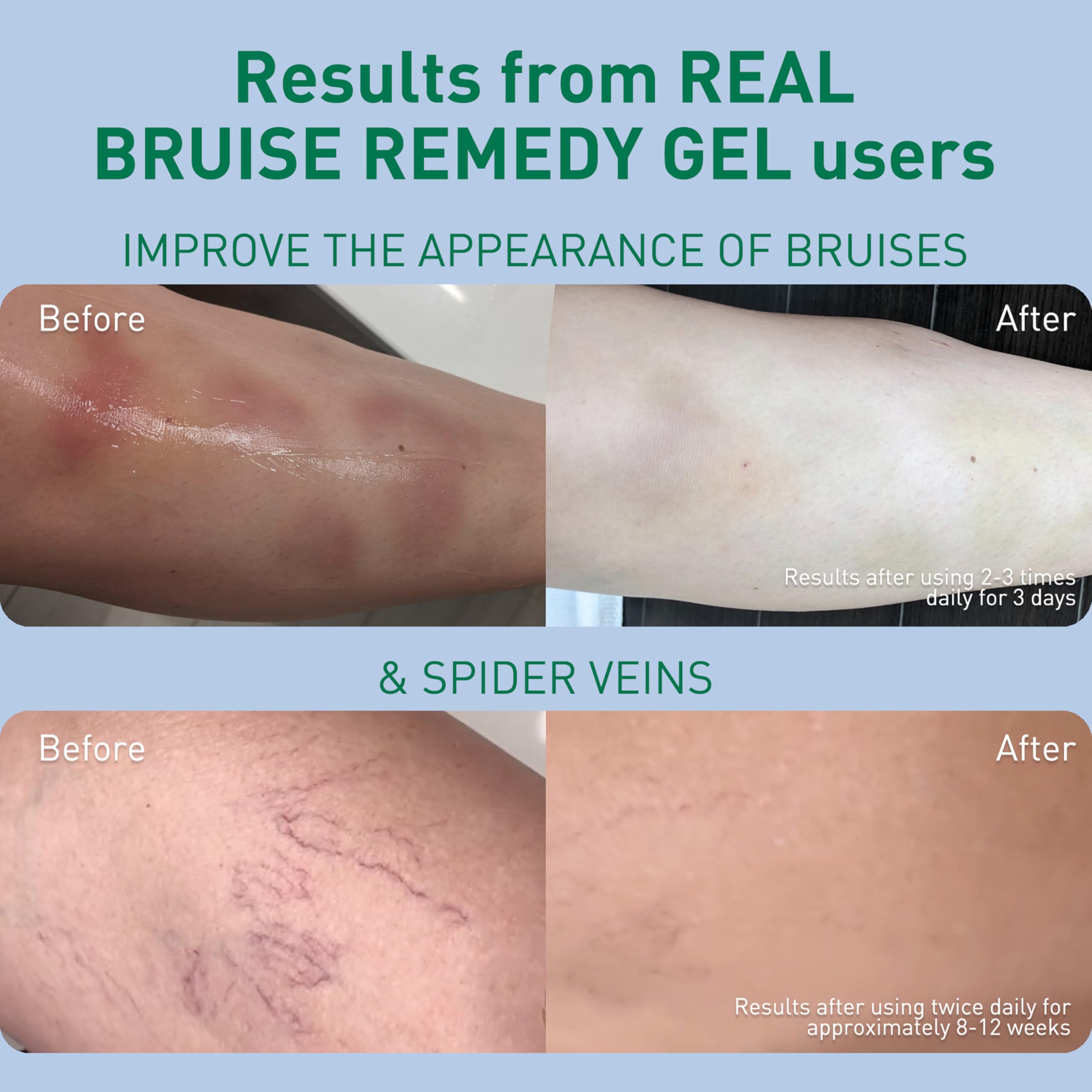 PROcure Arnica & MSM Bruise Remedy Gel – Paraben-Free, Unscented Arnica Montana Gel for Bruising, Spider Veins & Skin Discoloration – 2 Pack PROcure buy supplements canada