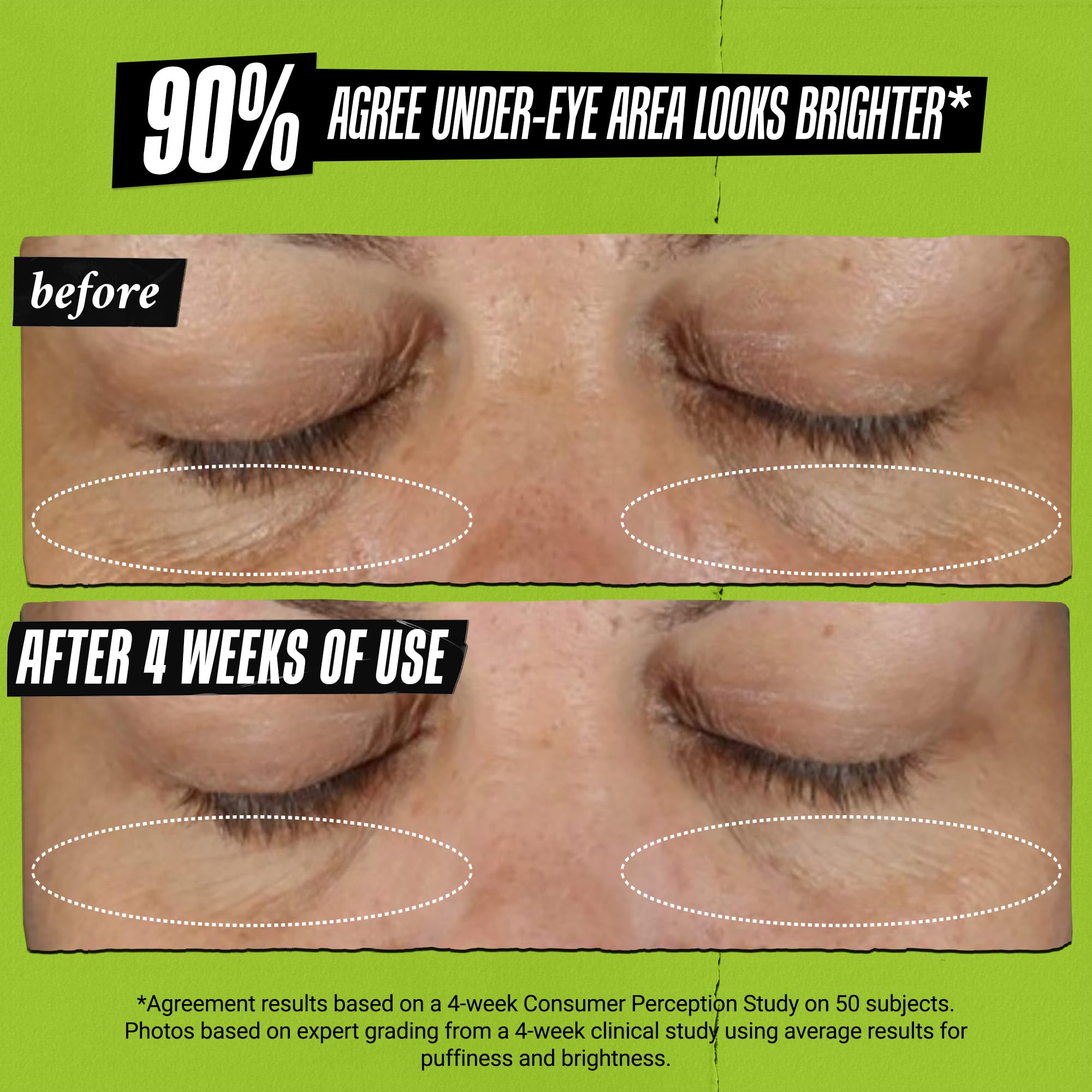 Kiehl's Avocado Eye Treatment, Nourishing and Hydrating Eye Cream, Avocado Oil and Caffeine to Energize and Invigorate Skin, Tired Eyes Kiehl's buy supplements canada