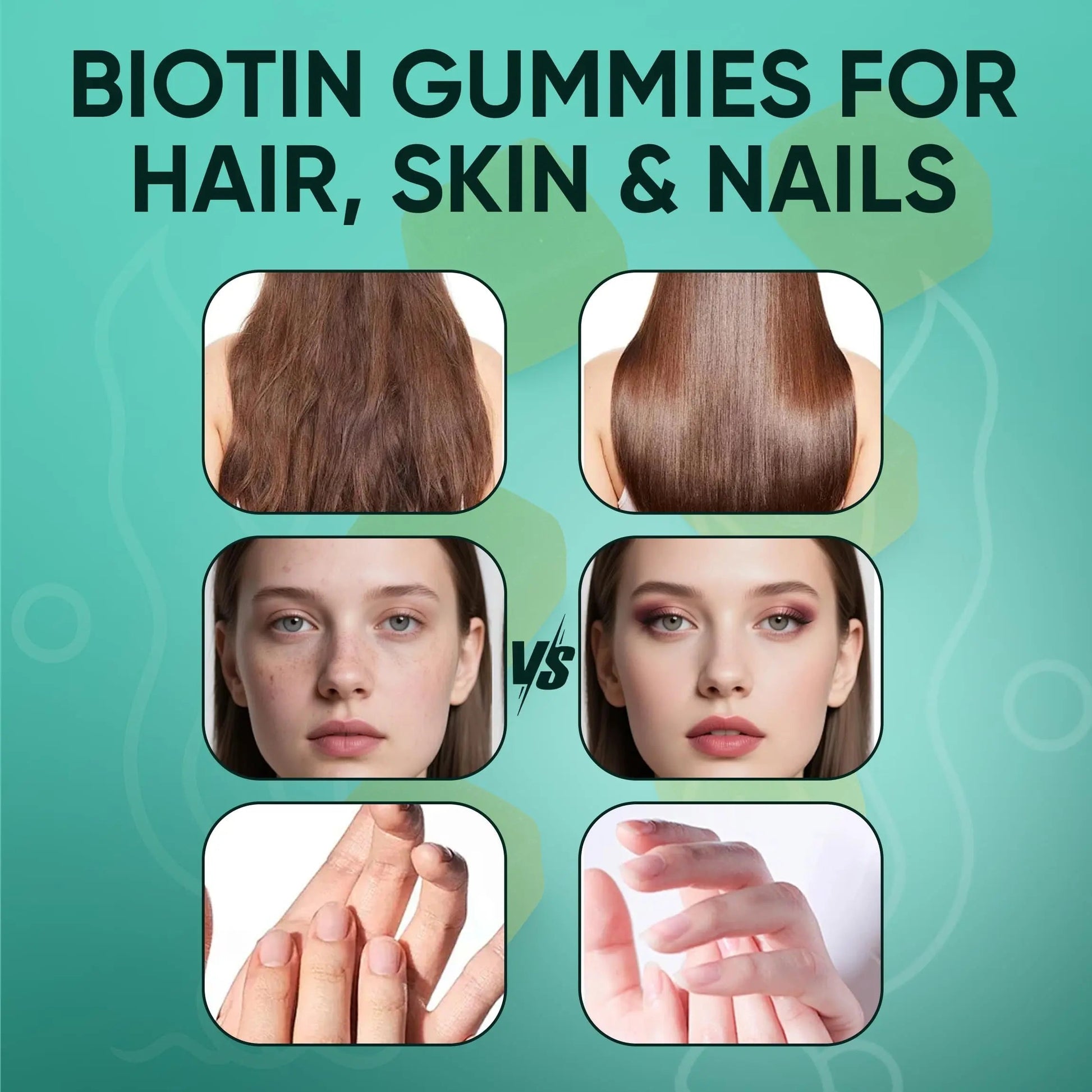 Neonomicon Balmbare Revive Gummies for Hair Loss - Sea Moss Gummies with Vitamin C, Vitamin E, Aloe Vera, Pearl Powder Supports Faster Hair Growth Neonomicon buy supplements canada