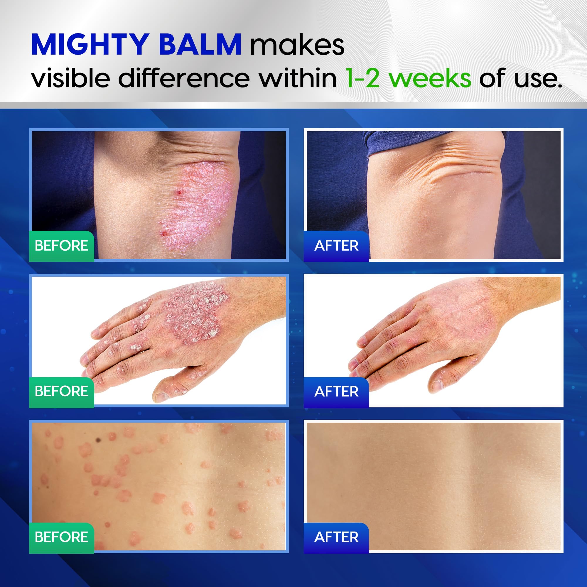 Tobcharm Antifungal Cream, Antifungal Cream for Skin, Ringworm Treatment for Humans Tobcharm buy supplements canada