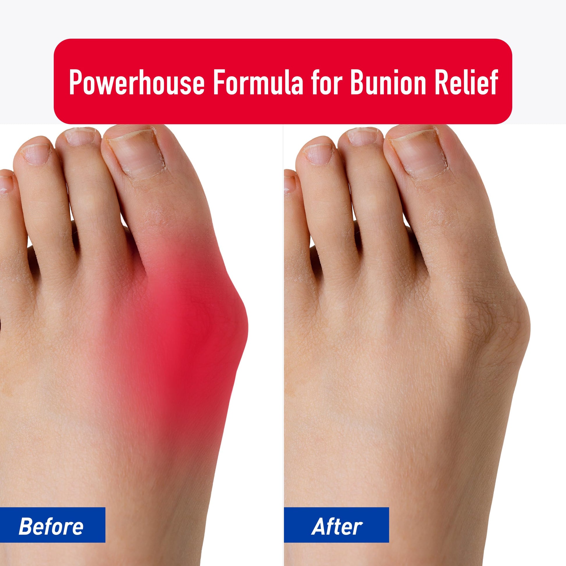 PROFOOT Bunion Relief Rub, White Heal&Rescue buy supplements canada