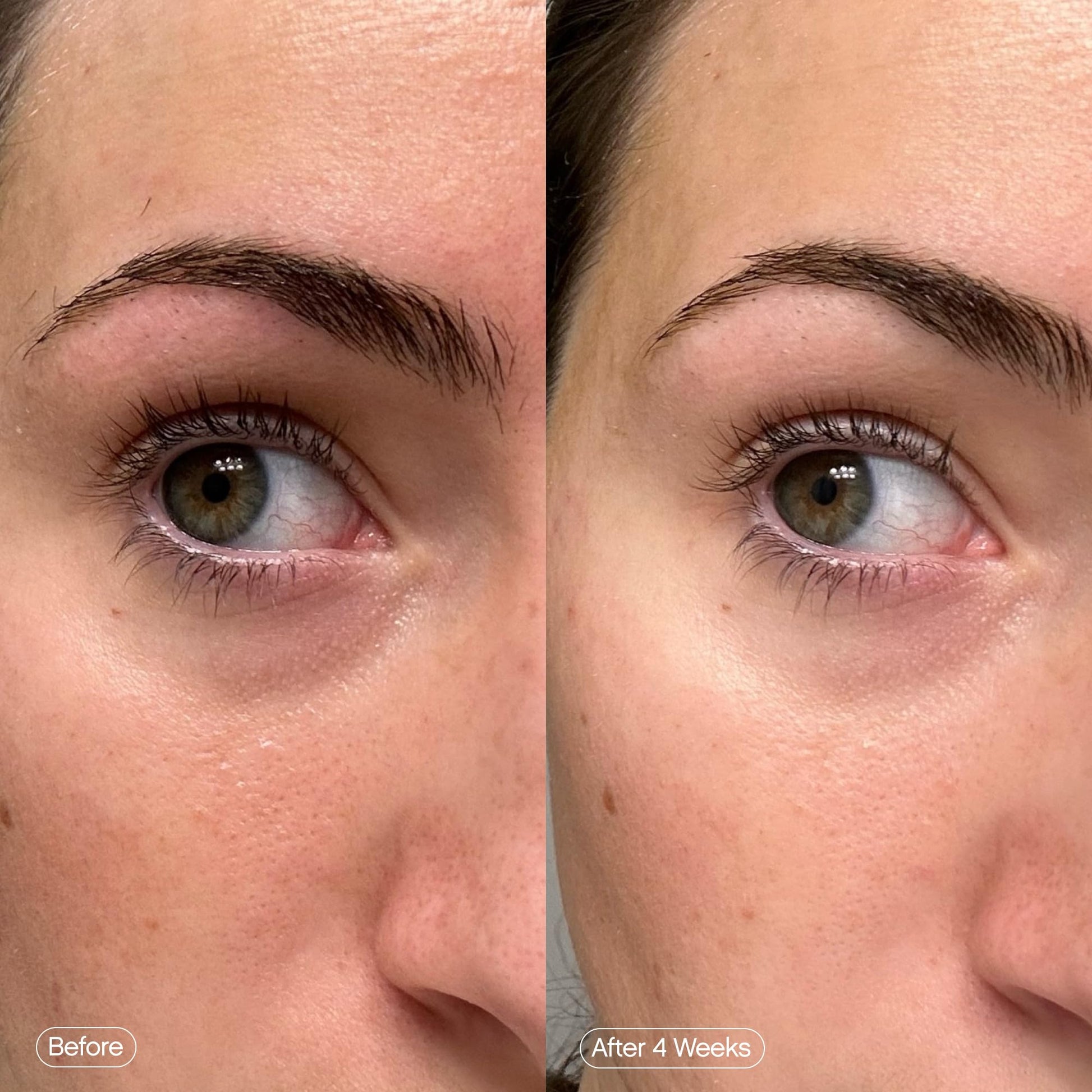 Topicals Faded Brightening Under Eye Masks | Patches to Depuff, Hydrate, Brighten and Cool | Reduce Dark Circles and Fine Lines | Contains Kojic Acid, Caffeine and Niacinamide (Set of 6) Topicals buy supplements canada