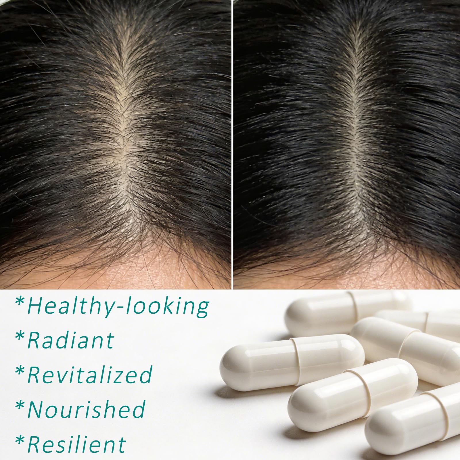 Hair Growth Biotin 10000mcg Supplement with Vitamins A C D E & Calcium - 30-in-1 Formula for Hair & Nails Support, for Women & Men, 30 Servings (1) WOJJ buy supplements canada