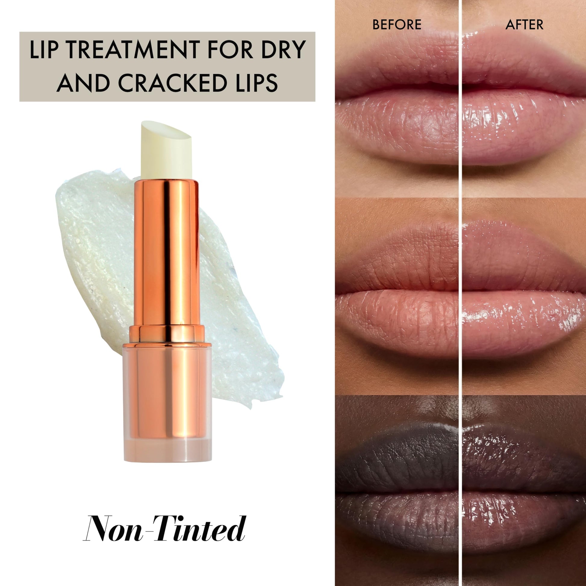 Clinexil Lip Balm – Hydrating Lip Repair with Cold-Pressed Oils, 10% Squalane, Vitamin E & Ceramides Clinexil buy supplements canada